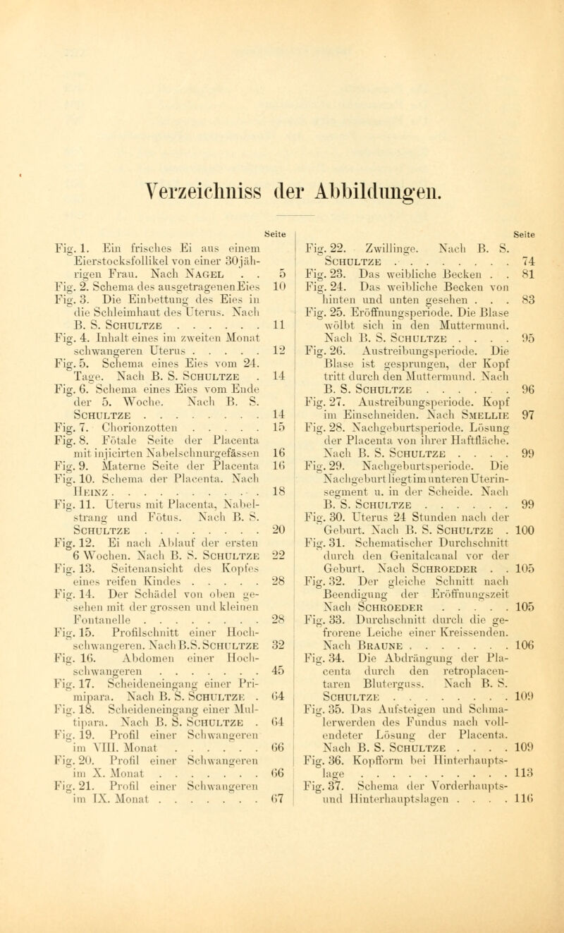 Verzeichniss der Abbildungen. Fig. 1. Ein frisches Ei aus einem Eierstocksfollikel von einer 30jäh- rigen Frau. Nach Nagel . . 5 Fig. 2. Schema des ausgetrageuenEies 10 Fig. 3. Die Einbettung des Eies in die Schleimhaut des Uterus. Nach B. S. SCHULTZE 11 Fig. 4. Inhalt eines im zweiten Monat schwangeren Uterus 12 I Fig. 5. Schema eines Eies vom 24. Tage. Nach B. S. Schultze . 14 Fig. 6. Schema eines Eies vom Ende der 5. Woche. Nach B. S. Schultze 14 Fig. 7. Chorionzotten 15 Fig. 8. Fötale Seite der Placenta mit injicirten Nabelsclmurgefässen 16 Fig. 9. Materne Seite der Placenta Kl Fig. 10. Schema der Placenta. Nach Heinz 18 Fig. 11. Uterus mit Placenta, Nabel- strang und Fötus. Nach B. S. Schultze 20 Fig. 12. Ei nach Ablaut der ersten 6 Wochen. Nach B. S. Schultze 22 Fig. 13. Seitenansicht des Kopfe.- eines reifen Kindes 28 Fig. 14. Der Schädel von oben ge- sehen mit der grossen und kleinen Fontanelle . ' 28 Fig. 15. Profilschnitt einer Hoch- schwangeren. Nach B.S.Schültze 32 Fig. 16. Abdomen einer Hoch- schwangeren 45 Fig. 17. Scheideneingang einer Pri- mipara. Nach B. S. Schultze . (14 , Fig. 18. Seheideneingang einer Mul- tipara. Nach B. S. Schultze . G4 \ Fig. 19. Profil einer Schwangeren im VIII. Monat G6 Fig. 20. Profil einer Schwangeren im X. Mnmit 66 Fig. 21. Profil einer Schwangeren im ÖL. Monal 67 Seite Fig. 22. Zwillinge. Nach B. S. Schultze 74 Fig. 23. Das weibliche Becken . . 81 Fig. 24. Das weibliche Becken von hinten und unten gesehen ... 83 Fig. 25. Eröffnungsperiode. Die Blase wölbt sich in den Muttermund. Nach B. S. Schultze . . . . 95 Fig. 26. Austreibungsperiode. Die Blase ist gesprungen, der Kopf tritt durch den Muttermund. Nach B. S. Schultze 96 Fig. 27. Austreibungsperiode. Kopf im Einschneiden. Nach Smellie 97 Fig. 28. Nachgeburtsperiode. Lösung der Placenta von ihrer Haftfläche. Nach B. S. Schultze .... 99 Fig. 29. Nachgeburtsperiode. Die Na c 11 geburt liegt im unteren Uterin- segment u. in der Scheide. Nach B. S. Schultze 99 Fig. 30. Uterus 24 Stunden nach der Geburt. Nach B. S. Schultze . 100 Fig. 31. Schematischer Durchschnitt durch den Genitalcanal vor der Geburt. Nach Schroeder . . 105 Fig. 32. Der gleiche Schnitt nach Beendigung der ErÖffnungszeit Nach Schroeder 105 Fig. 33. Durchschnitt durch die ge- frorene Leiche einer Kreissenden. Nach Braune 106 Fig. 34. Die Abdrängung der Pla- centa durch den retroplacen- taren Bluterguss. Nach B. S. Schultze 109 Fig. 35. Das Aufsteigen und Sehma- lerwerden des Fundus nach voll- endeter Lösung der Placenta. Nach B. S. Schultze .... 109 Fig. 36. Kopfform bei Hinterhaupts- lase 113 Fig. 37. Schema der Vorderhaupts- und Hinterhauptslagen .... 116
