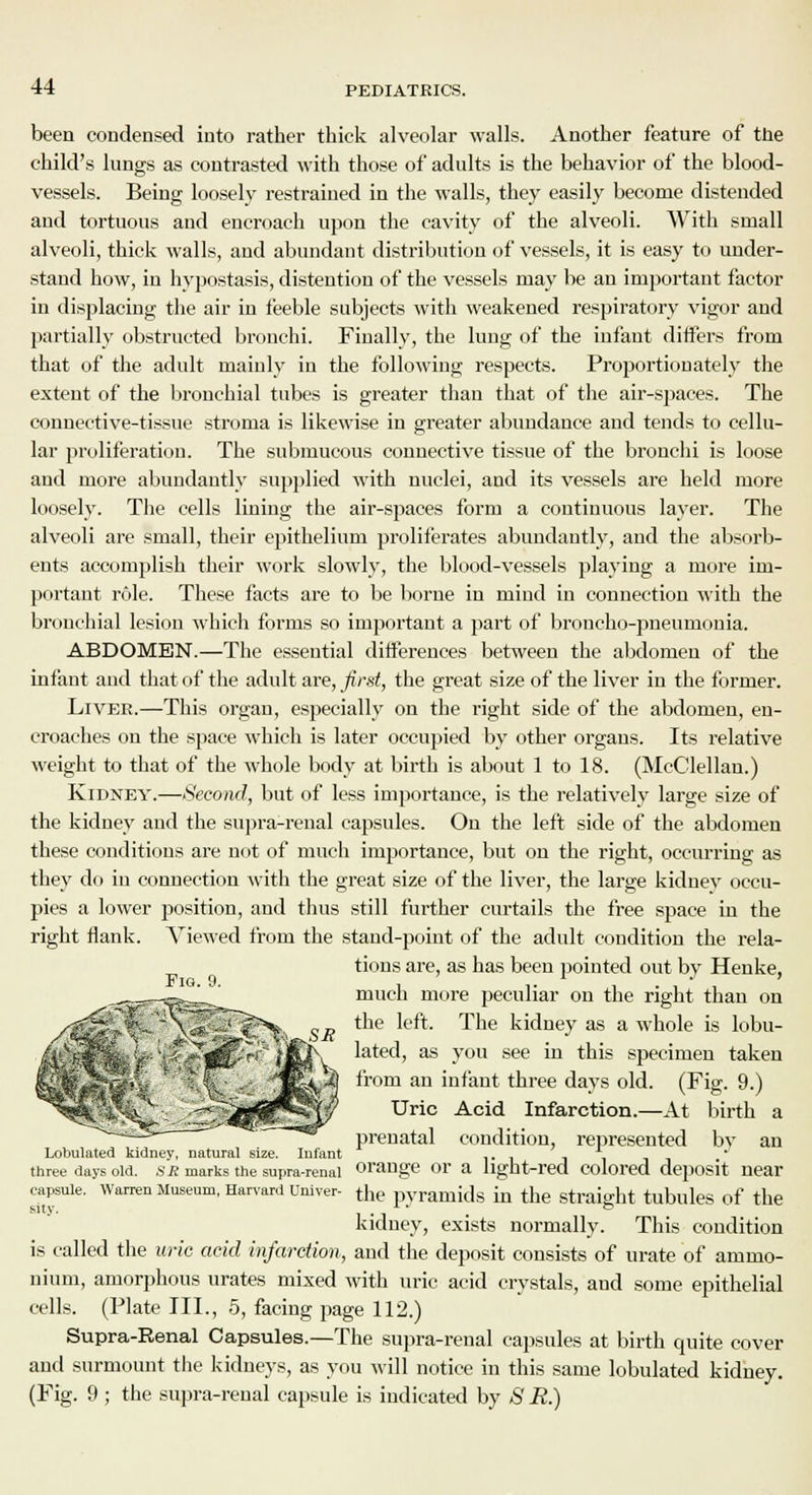 been condensed into rather thick alveolar walls. Another feature of the child's lungs as contrasted with those of adults is the behavior of the blood- vessels. Being loosely restrained in the walls, they easily become distended and tortuous and encroach upon the cavity of the alveoli. With small alveoli, thick walls, and abundant distribution of vessels, it is easy to under- stand how, in hypostasis, distention of the vessels may be an important factor in displacing the air in feeble subjects with weakened respiratory vigor and partially obstructed bronchi. Finally, the lung of the infant differs from that of the adult mainly in the following respects. Proportionately the extent of the bronchial tubes is greater than that of the air-spaces. The connective-tissue stroma is likewise in greater abundance and tends to cellu- lar proliferation. The submucous connective tissue of the bronchi is loose and more abundantly supplied with nuclei, and its vessels are held more loosely. The cells lining the air-spaces form a continuous layer. The alveoli are small, their epithelium proliferates abundantly, and the absorb- ents accomplish their work slowly, the blood-vessels playing a more im- portant role. These facts are to be borne in mind in connection with the bronchial lesion which forms so important a part of broncho-pneumonia. ABDOMEN.—The essential differences between the abdomen of the infant and that of the adult are, first, the great size of the liver in the former. Liver.—This organ, especially on the right side of the abdomen, en- croaches on the space which is later occupied by other organs. Its relative weight to that of the whole body at birth is about 1 to 18. (McClellan.) Kidney.—Second, but of less importance, is the relatively large size of the kidney and the supra-renal capsules. On the left side of the abdomen these conditions are not of much importance, but on the right, occurring as they do in connection with the great size of the liver, the large kidney occu- pies a lower position, and thus still further curtails the free space in the right flank. Viewed from the stand-point of the adult condition the rela- tions are, as has been pointed out by Henke, much more peculiar on the right than on the left. The kidney as a whole is lobu- lated, as you see in this specimen taken from an infant three days old. (Fig. 9.) Uric Acid Infarction.—At birth a prenatal condition, represented by an Lobulated kidnev, natural size. Infant ... - .. three days old. sb marks the supra-renal orange or a light-red colored deposit near capsule. Warren Museum, Harvard Univer- the pyramids in the Straight tubules of the kidney, exists normally. This condition is called the uric acid infarction, and the deposit consists of urate of ammo- nium, amorphous urates mixed with uric acid crystals, and some epithelial cells. (Plate III., 5, facing page 112.) Supra-Renal Capsules.—The supra-renal capsules at birth quite cover and surmount the kidneys, as you will notice in this same lobulated kidney. (Fig. 9 ; the supra-renal capsule is indicated by *S' jR.)