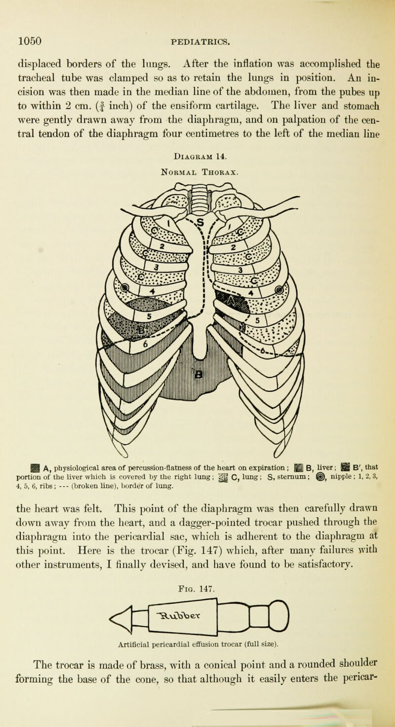 displaced borders of the lungs. After the inflation was accomplished the tracheal tube was clamped so as to retain the lungs in position. An in- cision was then made in the median line of the abdomen, from the pubes up to within 2 cm. (f inch) of the ensiform cartilage. The liver and stomach were gently drawn away from the diaphragm, and on palpation of the cen- tral tendon of the diaphragm four centimetres to the left of the median line Diagram 14. Normal Thorax. H A, physiological area of percussion-flatness of the heart on expiration; ||j B, liver; f$i B', that portion of the liver which is covered by the right lung; jgy C, lung; S, sternum; ©, nipple ; 1, 2, 3, 4, 5, 6, ribs; --- (broken line), border of lung. the heart was felt. This point of the diaphragm was then carefully drawn down away from the heart, and a dagger-pointed trocar pushed through the diaphragm into the pericardial sac, which is adherent to the diaphragm at this point. Here is the trocar (Fig. 147) which, after many failures with other instruments, I finally devised, and have found to be satisfactory. Fig. 147. < Artificial pericardial effusion trocar (full size). The trocar is made of brass, with a conical point and a rounded shoulder forming the base of the cone, so that although it easily enters the pericar-