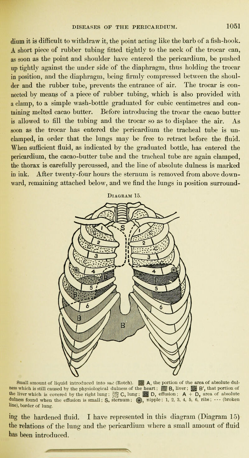 dium it is difficult to withdraw it, the point acting like the barb of a fish-hook. A short piece of rubber tubing fitted tightly to the neck of the trocar can, as soon as the point and shoulder have entered the pericardium, be pushed up tightly against the under side of the diaphragm, thus holding the trocar in position, and the diaphragm, being firmly compressed between the shoul- der and the rubber tube, prevents the entrance of air. The trocar is con- nected by means of a piece of rubber tubing, which is also provided with a clamp, to a simple wash-bottle graduated for cubic centimetres and con- taining melted cacao butter. Before introducing the trocar the cacao butter is allowed to fill the tubing and the trocar so as to displace the air. As soon as the trocar has entered the pericardium the tracheal tube is un- damped, in order that the lungs may be free to retract before the fluid. When sufficient fluid, as indicated by the graduated bottle, has entered the pericardium, the cacao-butter tube and the tracheal tube are again clamped, the thorax is carefully percussed, and the line of absolute dulness is marked hi ink. After twenty-four hours the sternum is removed from above down- ward, remaining attached below, and we find the lungs in position surround- Diaoram 15. Small amount of liquid introduced into sac (Rotch). Hf A, the portion of the area of absolute dul- ness which is still caused by the physiological dulness of the heart ; ff B, liyer; JfljJ B', that portion of the liver which is covered by the right lung; ?i?J C, lung; gg D, effusion; A + D, area of absolute dulness found when the effusion is small; S, sternum; (^), nipple; 1, 2, 3, 4, 5, 6, ribs; --- (broken line), border of lung. ing the hardened fluid. I have represented in this diagram (Diagram 15) the relations of the lung and the pericardium where a small amount of fluid has been introduced.