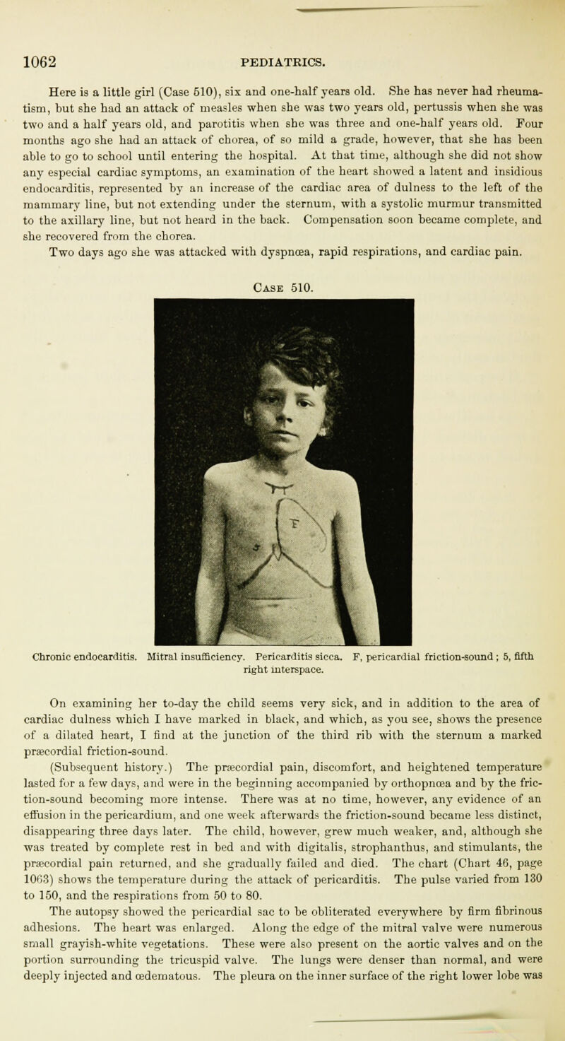 Here is a little girl (Case 510), six and one-half years old. She has never had rheuma- tism, but she had an attack of measles when she was two years old, pertussis when she was two and a half years old, and parotitis when she was three and one-half years old. Pour months ago she had an attack of chorea, of so mild a grade, however, that she has been able to go to school until entering the hospital. At that time, although she did not show any especial cardiac symptoms, an examination of the heart showed a latent and insidious endocarditis, represented by an increase of the cardiac area of dulness to the left of the mammary line, but not extending under the sternum, with a systolic murmur transmitted to the axillary line, but not heard in the back. Compensation soon became complete, and she recovered from the chorea. Two days ago she was attacked with dyspnoea, rapid respirations, and cardiac pain. Case 510. Chronic endocarditis. Mitral insufficiency. Pericarditis sicca. F, pericardial friction-sound ; 5, fifth right interspace. On examining her to-day the child seems very sick, and in addition to the area of cardiac dulness which I have marked in black, and which, as you see, shows the presence of a dilated heart, I find at the junction of the third rib with the sternum a marked precordial friction-sound. (Subsequent history.) The precordial pain, discomfort, and heightened temperature lasted for a few days, and were in the beginning accompanied by orthopncea and by the fric- tion-sound becoming more intense. There was at no time, however, any evidence of an efiusion in the pericardium, and one week afterwards the friction-sound became less distinct, disappearing three days later. The child, however, grew much weaker, and, although she was treated by complete rest in bed and with digitalis, strophanthus, and stimulants, the precordial pain returned, and she gradually failed and died. The chart (Chart 46, page 1003) shows the temperature during the attack of pericarditis. The pulse varied from 130 to 150, and the respirations from 50 to 80. The autopsy showed the pericardial sac to be obliterated everywhere by firm fibrinous adhesions. The heart was enlarged. Along the edge of the mitral valve were numerous small grayish-white vegetations. These were also present on the aortic valves and on the portion surrounding the tricuspid valve. The lungs were denser than normal, and were deeply injected and cedematous. The pleura on the inner surface of the right lower lobe was