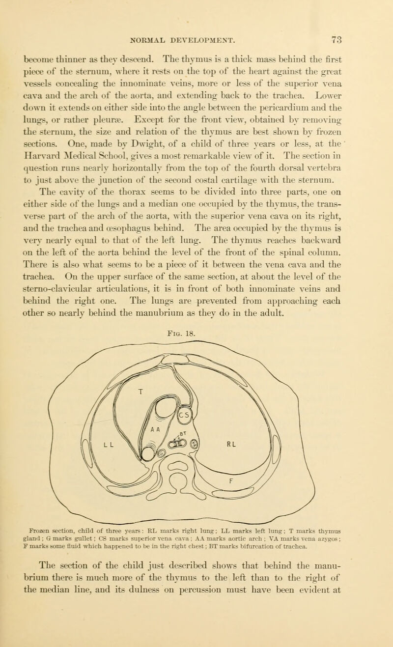 become thinner as they descend. The thymus i- a thick mass behind the first piece of the sternum, where it rests on the top of the heart against the great vessels concealing the innominate veins, more or less ol* the superior vena cava and the arch of the aorta, and extending back to the trachea. Lower down it extend- cm either side into the angle between the pericardium and the lungs, or rather pleurae. Except for the front view, obtained by removing the sternum, the size and relation of the thymus are best shown by frozen sections. One, made by Dwight, of a child of three years or less, at the Harvard Medical School, srives a most remarkable view of it. The section in question runs nearly horizontally from the top of the fourth dorsal vertebra t<> just above the junction of the second costal cartilage with the sternum. The cavity of the thorax seems to be divided into three parts, one on either side of the lungs and a median one occupied by the thymus, the trans- verse part of the arch of the aorta, with the .-uperior vena cava on its right, and the trachea and oesophagus behind. The area occupied by the thymus is very nearly equal to that of the left lung. The thymus reaches backward on the left of the aorta behind the level of the front of the spinal column. There is also what seems to be a piece of it between the vena cava and the trachea. On the upper surface of the same section, at about the level of the sterno-clavicular articulations, it is in front of both innominate veins and behind the right oue. The luntrs are prevented from approaching each other so nearly behind the manubrium as they do in the adult. Fig. 18. Frozen section, child of three years: RL marks right lung; LL marks left lung; T marks thymus gland ; G marks gullet: CS marks superior vena cava: AA marks aortic arch : VA marks vena azygos; F marks some fluid which happened to be in the right chest; BT marks bifurcation of trachea. The section of the child just described shows that behind the manu- brium there is much more of the thvmus to the left than to the right of the median line, and its dulness on percussion must have been evident at