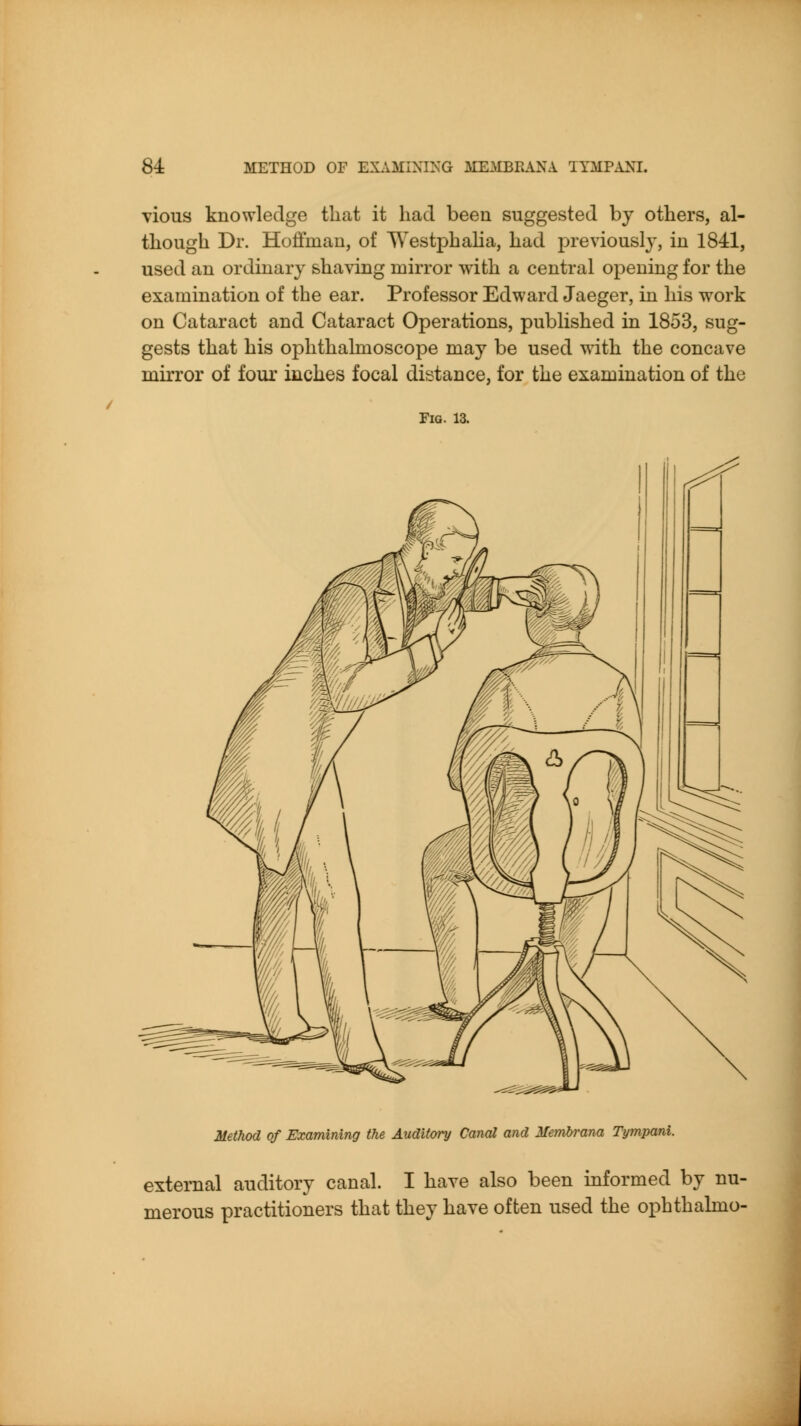 vious knowledge that it had been suggested by others, al- though Dr. Hoifman, of Westphaha, had previously, in 1841, used an ordinary shaving mirror with a central opening for the examination of the ear. Professor Edward Jaeger, in his work on Cataract and Cataract Operations, published in 1853, sug- gests that his ophthalmoscope may be used with the concave mirror of four inches focal distance, for the examination of the Fig. 13. MetJwd of Examining the Auditory Canal and Membrana Tympani. external auditory canal. I have also been mformed by nu- merous practitioners that they have often used the ophthalmo-