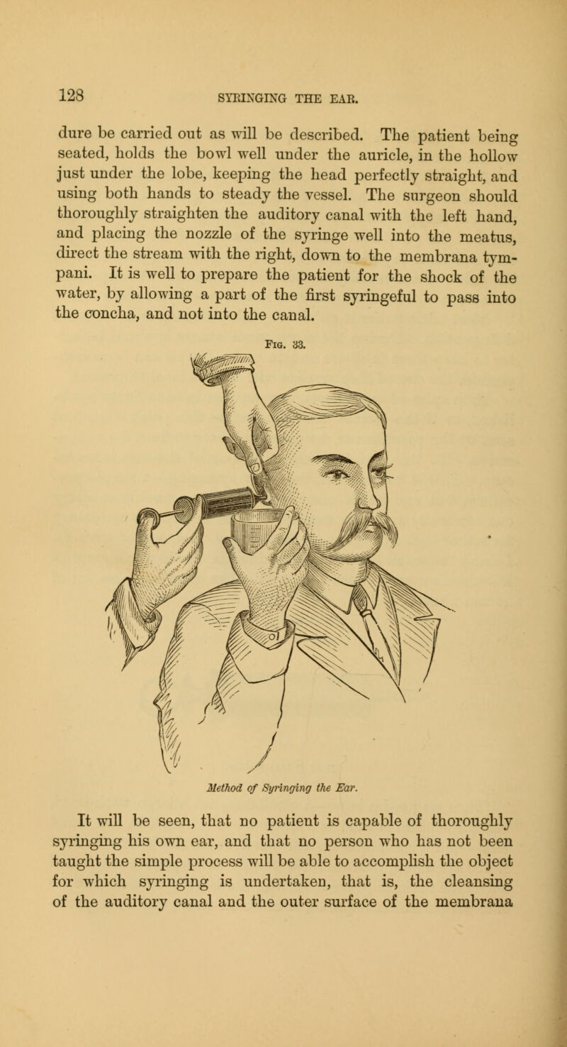 dure be carried out as will be described. The patient being seated, holds the bowl well under the auricle, in the hollow just under the lobe, keeping the head perfectly straight, and using both hands to steady the vessel. The surgeon should thoroughly straighten the auditory canal with the left hand, and placing the nozzle of the syringe well into the meatus, dii-ect the stream with the right, down to the membrana t}'m- pani. It is well to prepare the patient for the shock of the water, by allowing a part of the first syiingeful to pass into the concha, and not into the canal. Fig. 33. Method of Syringing the Ear. It will be seen, that no patient is capable of thoroughly syringing his own ear, and that no person who has not been taught the simple process will be able to accomplish the object for which syringing is undertaken, that is, the cleansing of the auditory canal and the outer surface of the membrana