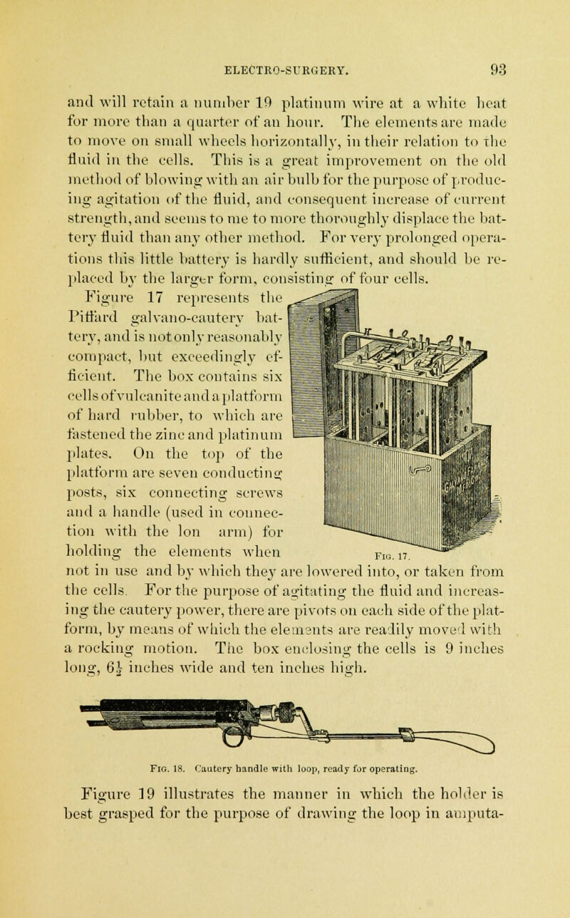 anil will retain a number 19 platinum wire at a white heat for more than a quarter of an hour. The elements are made to move on small wheels horizontally, in their relation to the fluid in the eells. This is a great improvement on the old method of blowing with an air bulb for the purpose of produc- ing agitation of the fluid, and consequent increase of current strength, and seems to me to more thoroughly displace the bat- tery fluid than any other method. For very prolonged opera- tions this little battery is hardly sufficient, and should be re- placed by the larger form, consisting of four cells. Figure 17 represents the ^ Pitfard galvano-cautery bat- ^L tery, and is not only reasonably IfjBBHjr^sgi? compact, but exceedingly ef- | ficient. The box contains six cells of vulcanite and a platform of hard rubber, to which are fastened the zinc and platinum plates. On the top of the platform are seven conducting posts, six connecting screws and a handle (used in connec- tion with the Ion arm) for holding the elements when not in use and by which they are lowered into, or taken from the cells. For the purpose of agitating the fluid and increas- ing the cautery power, there are pivots on each side of the plat- form, by means of which the elements are readily moved with a rocking motion. The box enclosing the cells is 9 inches long, 6£ inches wide and ten inches high. Fig. IS. Cautery handle with loop, ready for operating. Figure 19 illustrates the manner in which the holder is best grasped for the purpose of drawing the loop in amputa-