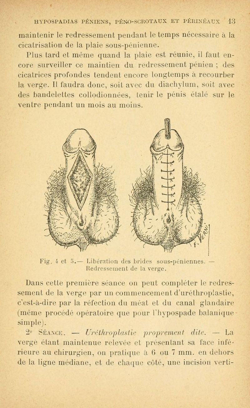 maintenir le redressement pendant le temps nécessaire à la cicatrisation de la plaie sons-pénienne. Plus tard et môme quand la plaie est réunie, il faut en- core surveiller ce maintien du redressement pénien ; des cicatrices profondes tendent encore longtemps à recourber la verge. Il faudra donc, soit avec du diachylum, soit avec des bandelettes collodionnées, tenir le pénis étalé sur le ventre pendant un mois au moins. Fis. et 5.— Libération des brides sous-péniennes. Redressement de la verge. Dans cette première séance on peut compléter le redres- sement de la verge par un commencement d'uréthroplastie, c'est-à-dire par la réfection du méat et du canal glandaire (même procédé opératoire que pour l'hypospade balanique simple). 2e Séance. — Urêthroplastie proprement dite. — La verge étant maintenue relevée et présentant sa face infé- rieure au chirurgien, on pratique à 6 ou 7 mm. en dehors de la ligne médiane, et de chaque côté, une incision verti-