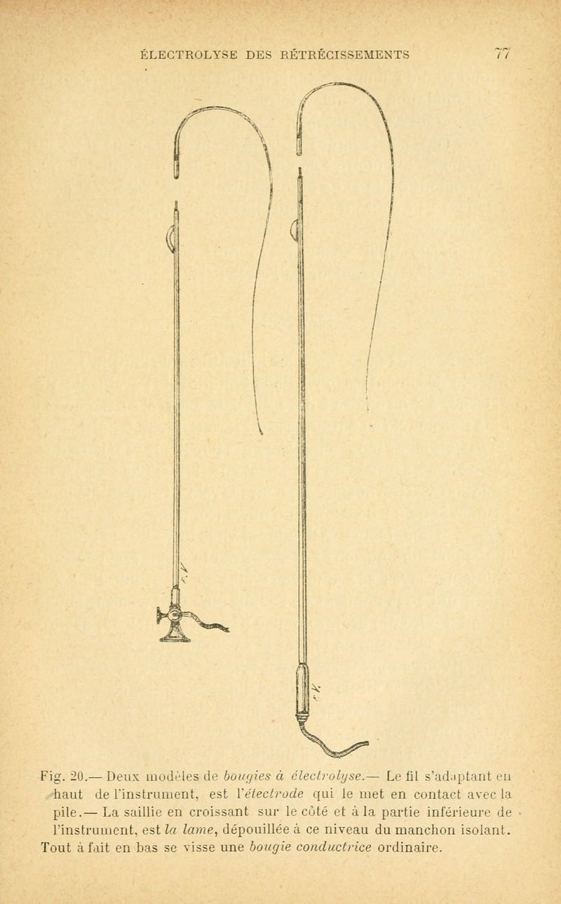 ÉLEGTROLYSE DES RÉTRÉCISSEMENTS Fig. 20.— Deux modèles de bougies à électrolyse.— Le fil s'àdaptant eu haut de l'instrument, est Yétectrode qui le met en contact avec la pile.— La saillie en croissant sur le cùté et à la partie inférieure de l'instrument, est la lame, dépouillée à ce niveau du manchon isolant. Tout à fait en bas se visse une bougie conductrice ordinaire.