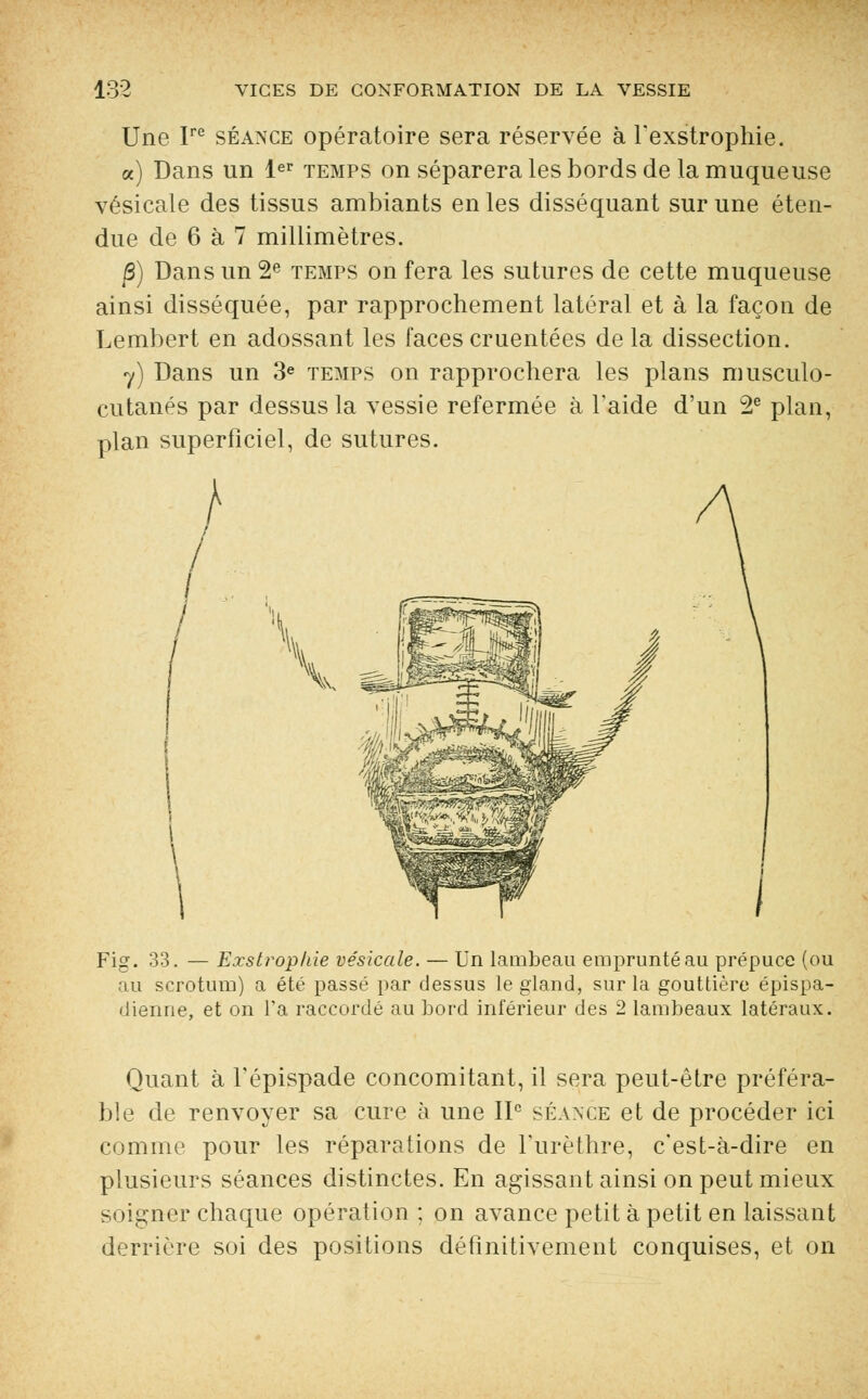 Une Ire séance opératoire sera réservée à Texstrophie. a) Dans un 1er temps on séparera les bords de la muqueuse vésicale des tissus ambiants en les disséquant sur une éten- due de 6 à 7 millimètres. ]3) Dans un 2e temps on fera les sutures de cette muqueuse ainsi disséquée, par rapprochement latéral et à la façon de Lembert en adossant les faces cruentées de la dissection. y) Dans un 3e temps on rapprochera les plans musculo- cutanés par dessus la vessie refermée à faide d'un 2e plan, plan superficiel, de sutures. Fig. 33. — Exstvopkie vésicale. — Un lambeau emprunté au prépuce (ou au scrotum) a été passé par dessus le gland, sur la gouttière épispa- dienne, et on l'a raccordé au bord inférieur des 2 lambeaux latéraux. Quant à fépispade concomitant, il sera peut-être préféra- ble de renvoyer sa cure à une IIe séance et de procéder ici comme pour les réparations de Furèthre, c'est-à-dire en plusieurs séances distinctes. En agissant ainsi on peut mieux soigner chaque opération ; on avance petit à petit en laissant derrière soi des positions définitivement conquises, et on