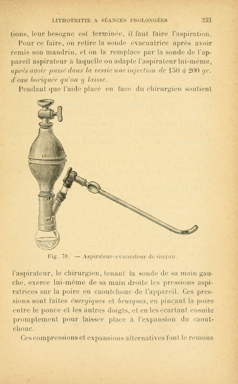 tions, leur besogne est terminée, il faut faire l'aspiration. Pour ce faire, on retire la sonde évacuatrice après avoir remis son mandrin, et on la remplace par la sonde de l'ap- pareil aspirateur à laquelle on adapte l'aspirateur lui-même, après avoir passé dans la vessie une injection de 150 a 200 gr. d'eau boriquée qu'on y laisse. Pendant que l'aide placé en face du chirurgien soutient Fig. 70. Aspirateur-évacuateur de Guyon. l'aspirateur, le chirurgien, tenant la sonde de sa main gau- che, exerce lui-même de sa main droite les pressions aspi- ratrices sur la poire en caoutchouc de l'appareil. Ces pres- sions sont faites énergiques et brusques, en pinçant la poire entre le pouce et les autres doigts, et en les écartant ensuite promptement pour laisser place à l'expansion du caout- chouc. Ces compressions et expansions alternatives font le remous