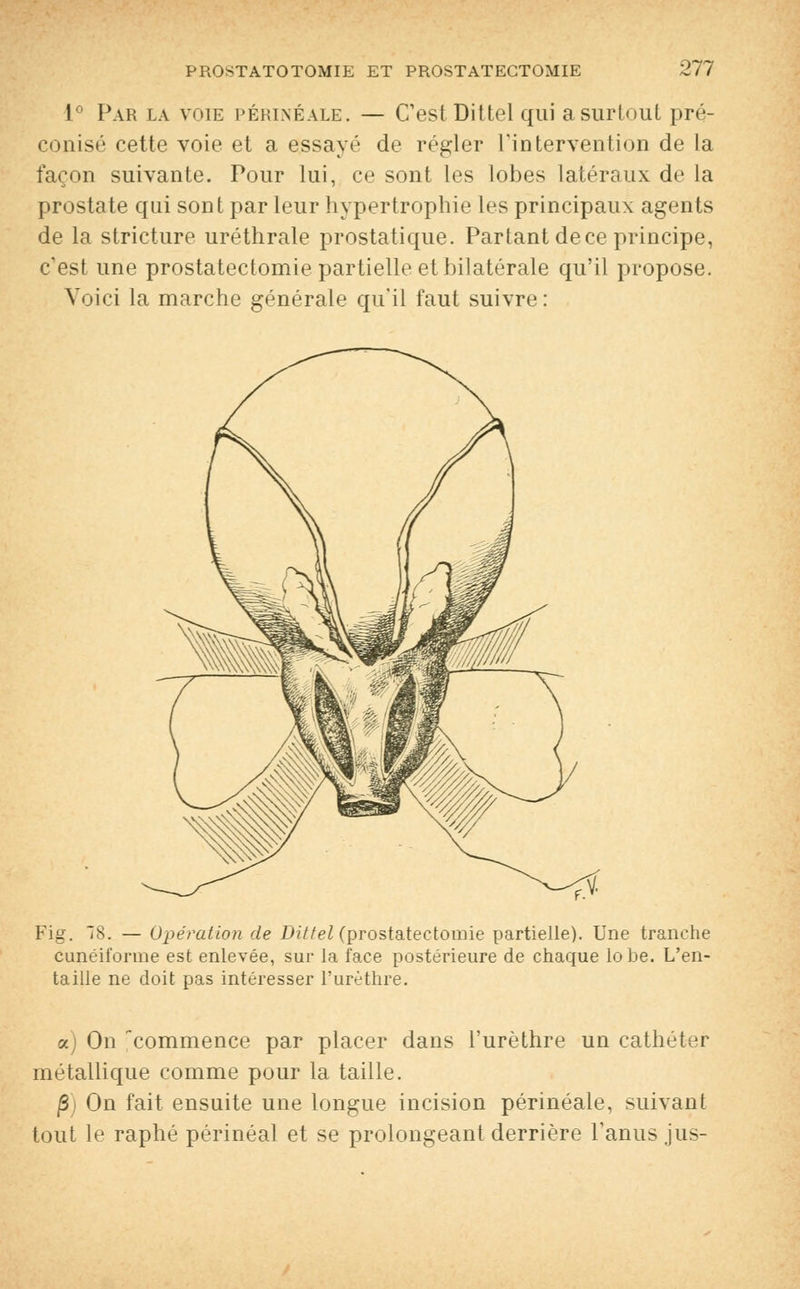 1° Par la voie périnéale. — C'est Dittel qui a surtout pré- conisé cette voie et a essayé de régler l'intervention de la façon suivante. Pour lui, ce sont les lobes latéraux de la prostate qui sont par leur hypertrophie les principaux agents de la stricture uréthrale prostatique. Partant de ce principe, c'est une prostatectomie partielle et bilatérale qu'il propose. Voici la marche générale qu'il faut suivre : Fig. 18. — Opération de Dittel (prostatectomie partielle). Une tranche cunéiforme est enlevée, sur la face postérieure de chaque lobe. L'en- taille ne doit pas intéresser l'urèthre. a) On commence par placer dans l'urèthre un cathéter métallique comme pour la taille. |3) On fait ensuite une longue incision périnéale, suivant tout le raphé périnéal et se prolongeant derrière l'anus jus-