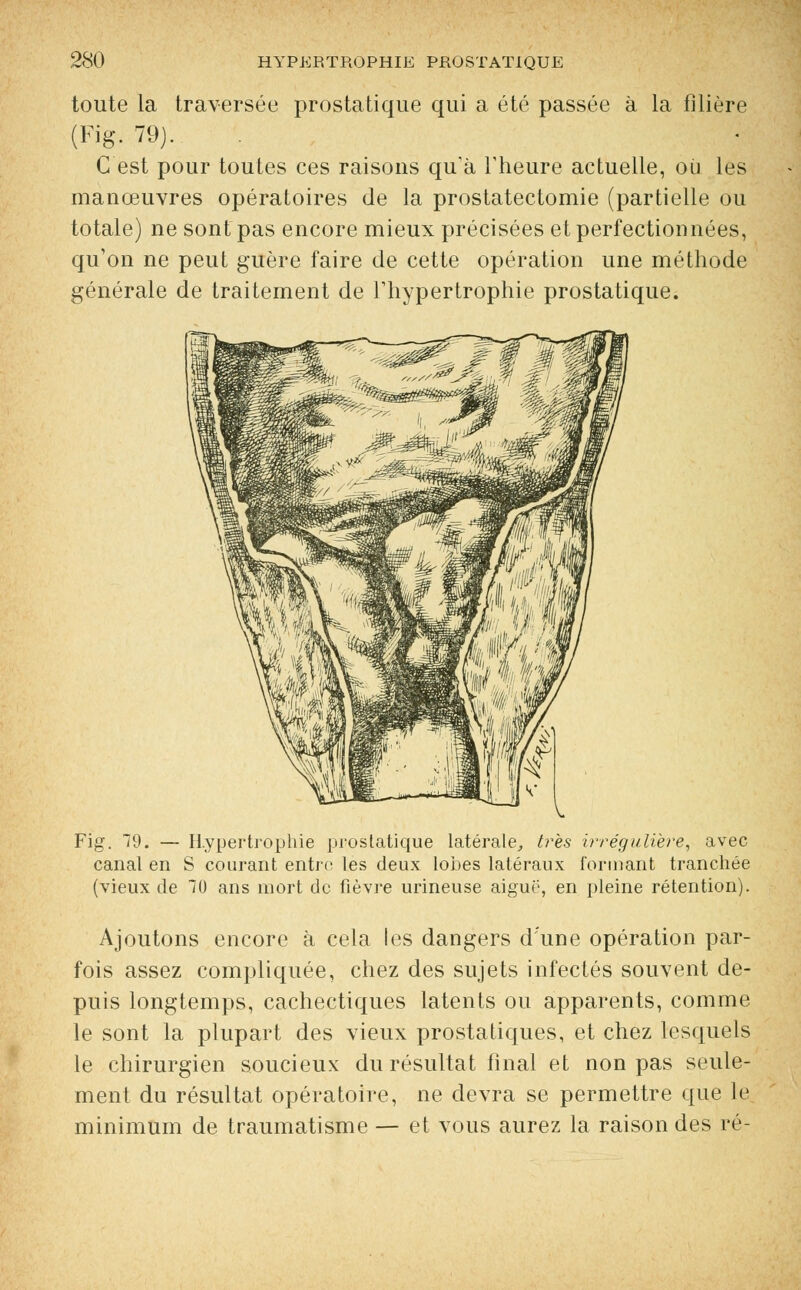 toute la traversée prostatique qui a été passée à la filière (Fig. 79). C'est pour toutes ces raisons qu'à l'heure actuelle, ou les manœuvres opératoires de la prostatectomie (partielle ou totale) ne sont pas encore mieux précisées et perfectionnées, qu'on ne peut guère faire de cette opération une méthode générale de traitement de l'hypertrophie prostatique. Fig. 79. — Hypertrophie prostatique latérale, très irrégulière, avec canal en S courant entre les deux lobes latéraux formant tranchée (vieux de 70 ans mort de fièvre urineuse aiguë, en pleine rétention). Ajoutons encore à cela les dangers d'une opération par- fois assez compliquée, chez des sujets infectés souvent de- puis longtemps, cachectiques latents ou apparents, comme le sont la plupart des vieux prostatiques, et chez lesquels le chirurgien soucieux du résultat final et non pas seule- ment du résultat opératoire, ne devra se permettre que le minimum de traumatisme — et vous aurez la raison des ré-