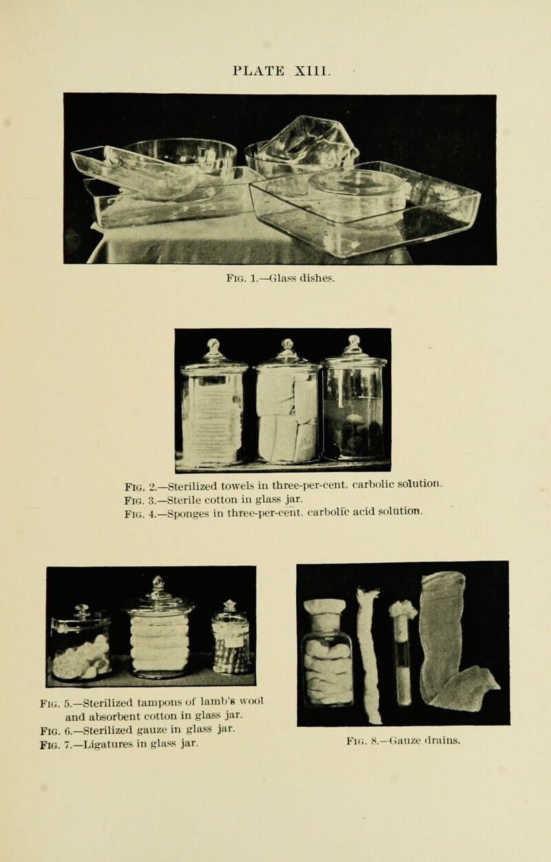 PLATE XIII. Fig. 1.—Glass dishes. 1 1 1 1 1 I I Fig. 2.—Sterilized towels in three-per-eent. carbolic solution. Fig. 3.—Sterile cotton in glass jar. Fig. 4.—Sponges in three-per-cent. carbolic acid solution. Fig. 5.—Sterilized tampons of lamb's wool and absorbent cotton in glass jar. Fig. 6.—Sterilized gauze in glass jar. Fig. 7.—Ligatures in glass jar.