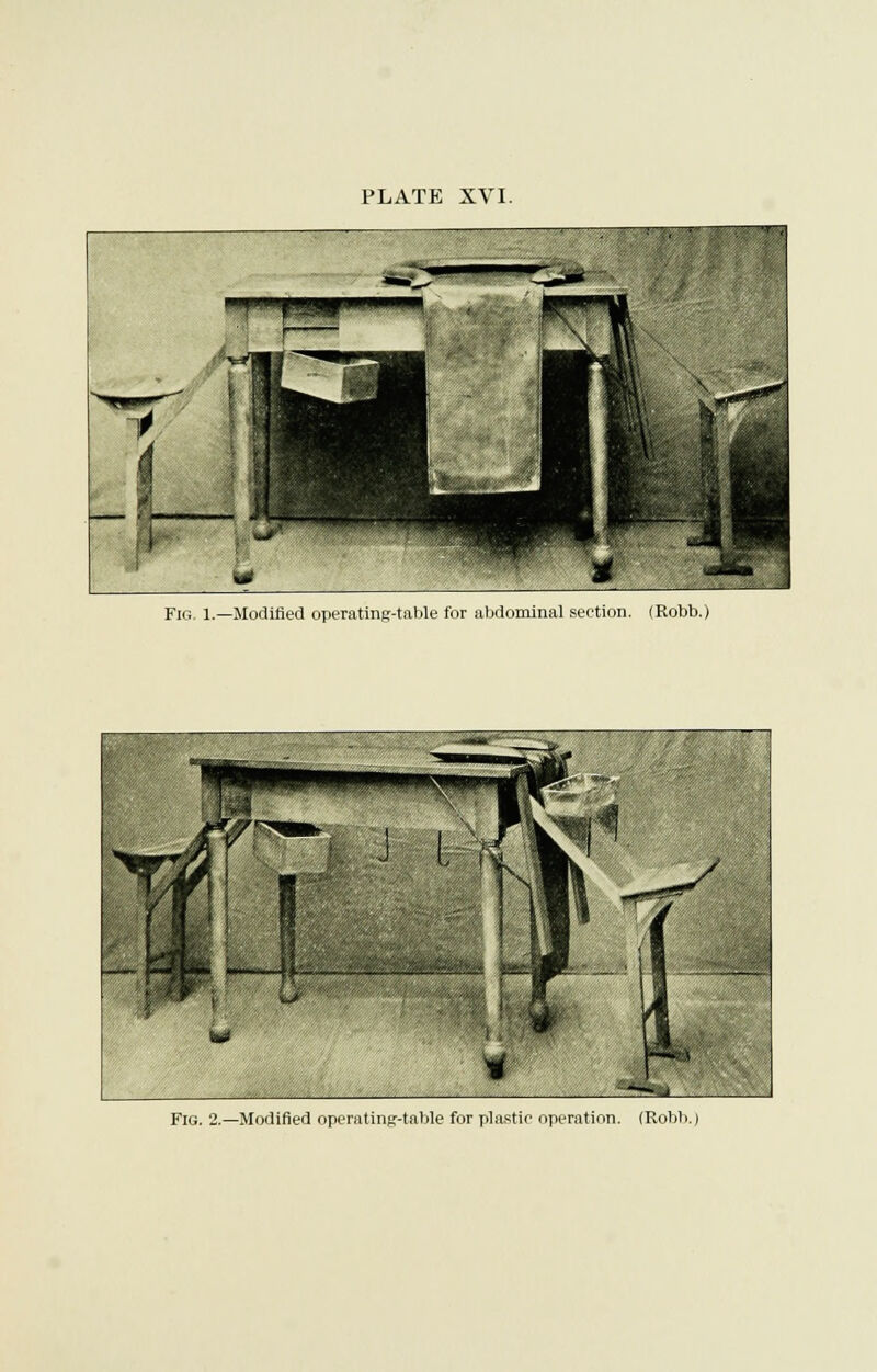 Fig. 1.—Modified operating-table for abdominal section. (Robb. Fig. 2.—Modified operating-table for plastic operation. (Robb.)