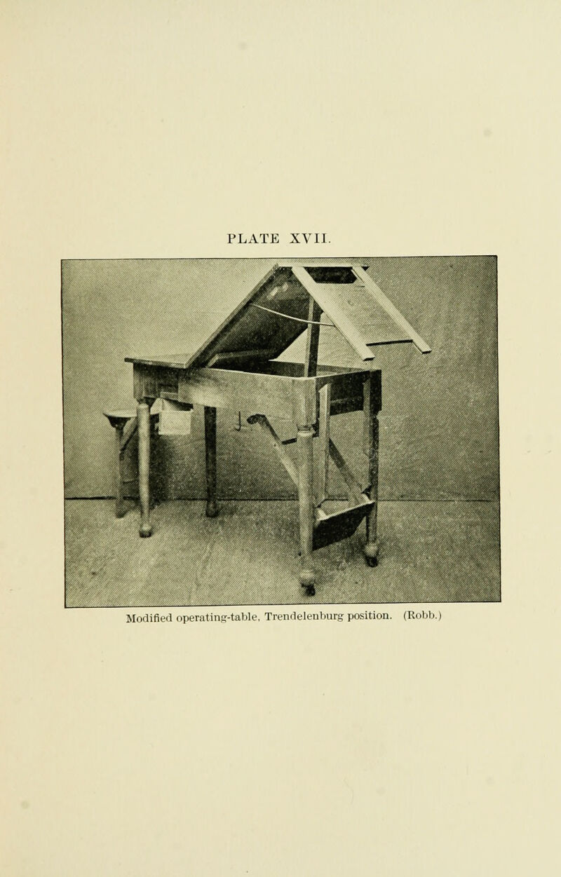 Modified operating-table, Trendelenburg position. (Robb.)