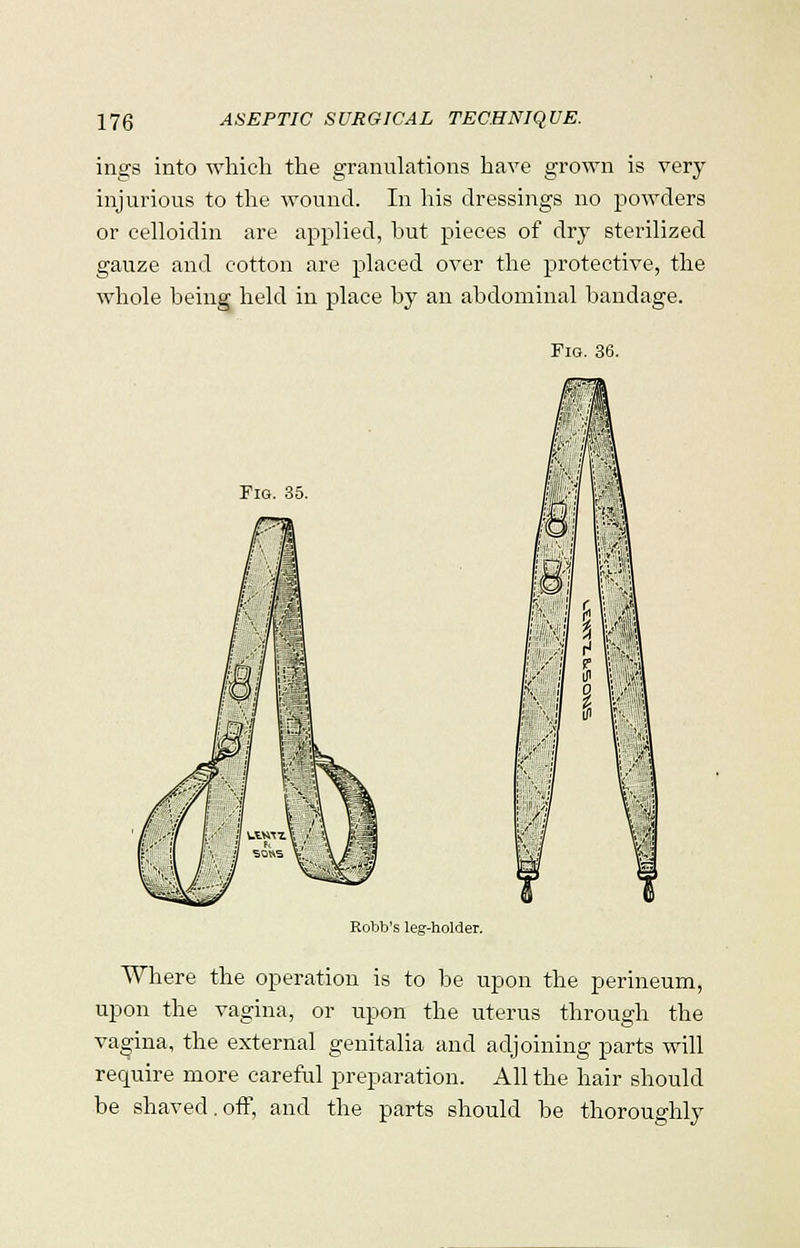 ings into which the granulations have grown is very injurious to the wound. In his dressings no powders or celloidin are applied, but pieces of dry sterilized gauze and cotton are placed over the protective, the whole being held in place by an abdominal bandage. Fio. 36. Fig. 35. Robb's leg-holder. Where the operation is to be upon the perineum, upon the vagina, or upon the uterus through the vagina, the external genitalia and adjoining parts will require more careful preparation. All the hair should be shaved. off, and the parts should be thoroughly