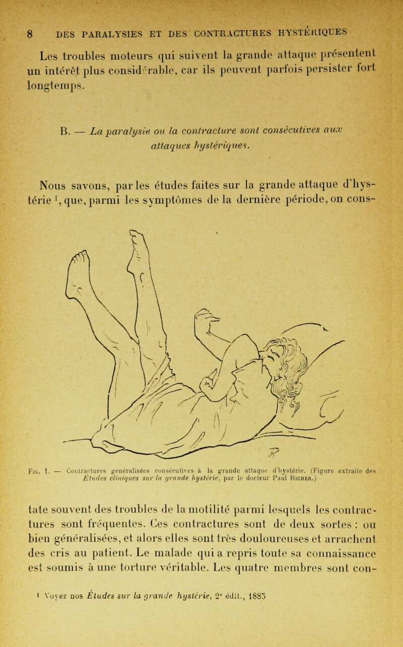 Les troubles moteurs qui suivent la grande attaque présentent un intérêt plus considérable, car ils peuvent parfois persister fort longtemps. B. — La paralysie ou la contracture sont consécutives aux attaques hystériques. Nous savons, parles études faites sur la grande attaque d'hys- térie ', que, parmi les symptômes de la dernière période, on cons- Fie. 1. — Contractures généralisées consécutives à la grande atlaque d'hystérie. (Figure extraite des Éludes cliniques sue tu grande hystérie, par le docteur Paul Hicher.) tate souvent des troubles de la motilité parmi lesquels les contrac- tures sont fréquentes. Ces contractures sont de deux sortes : ou bien généralisées, et alors elles sont très douloureuses et arrachent des cris au patient. Le malade quia repris toute sa connaissance est soumis à une torture véritable. Les quatre membres sont con- Vuyez aus Études sur la grande, hystérie, 2° édit., 18S3