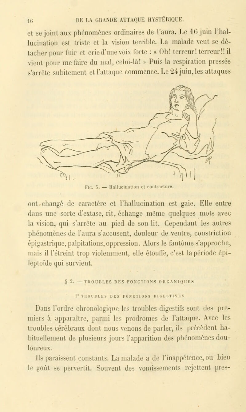 et se joint aux phénomènes ordinaires de l'aura. Le 16 juin l'hal- lucination est triste et la vision terrible. La malade veut se dé- tacher pour fuir et crie d'une voix forte : a Oh! terreur! terreur'.! il vient pour me faire du mal, celui-là! » Puis la respiration pressée .-'arrête subitement et l'attaque commence. Le 24 juin,les attaques Fig. 5. — Hallucination et contracture. ont changé de caractère et l'hallucination est gaie. Elle entre dans une sorte d'extase, rit, échange même quelques mots avec la vision, qui s'arrête au pied de son lit. Cependant les autres phénomènes de l'aura s'accusent, douleur de ventre, constriction épigastrique, palpitations, oppression. Alors le fantôme s'approche, mais il l'étreint trop violemment, elle étouffe, c'est la période épi- leploïde qui survient. § -2. — TROUBLES DES FONCTIONS ORGANIQUES 1° TROUBLES DES FONCTIONS DIGESTIVES Dans l'ordre chronologique les troubles digestifs sont des pre- miers à apparaître, parmi les prodromes de l'attaque. Avec les troubles cérébraux dont nous venons de parler, ils précèdent ha- bituellement de plusieurs jours l'apparition des phénomènes dou- loureux. Ils paraissent constants. La malade a de l'inappétence, ou bien le goût se pervertit. Souvent des vomissements rejettent près-