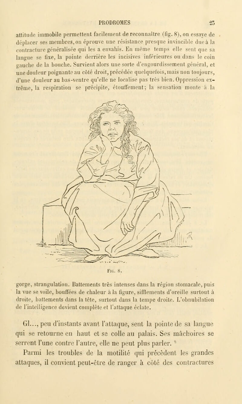 attitude immobile permettent facilement de reconnaître (fig. 8), on essaye de déplacer ses membres, on éprouve une résistance presque invincible due à la contracture généralisée qui les a envahis. En même temps elle sent que sa langue se fixe, la pointe derrière les incisives inférieures ou dans le coin gauche de la bouche. Survient alors une sorte d'engourdissement général, et une douleur poignante au côté droit, précédée quelquefois,mais non toujours, d'une douleur au bas-ventre qu'elle ne localise pas très bien. Oppression ex- trême, la respiration se précipite, étouffement; la sensation monte à la gorge, strangulation. Battements très intenses dans la région stomacale, puis la vue se voile, bouffées de chaleur à la figure, sifflements d'oreille surtout à droite, battements dans la tête, surtout dans la tempe droite. L'obnubilation de l'intelligence devient complète et l'attaque éclate. Gl..., peu d'instants avant l'attaque, sent la pointe de sa langue qui se retourne en haut et se colle au palais. Ses mâchoires se serrent l'une contre l'autre, elle ne peut plus parler. Parmi les trouhles de la motilité qui précèdent les grandes attaques, il convient peut-être de ranger à côté des contractures