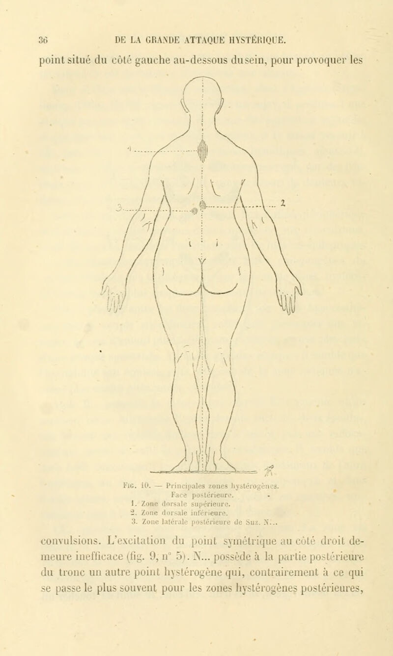 point situé du côté gauche au-dessous du sein, pour provoquer les FiG. il'. — Principales zones hystéro Face postérieure. 1. Zone dorsale supérieure. e dorsale inférieure. itérieure do m. convulsions. L'excitation du point symétrique iii de- meure inefficace (fig. (J, n° 5). N... possède à la partie postérieure du tronc un autre point hystérogène qui, contrairement à ce qui se nasse le plus souvent pour les zones hystérogènes postérieures,