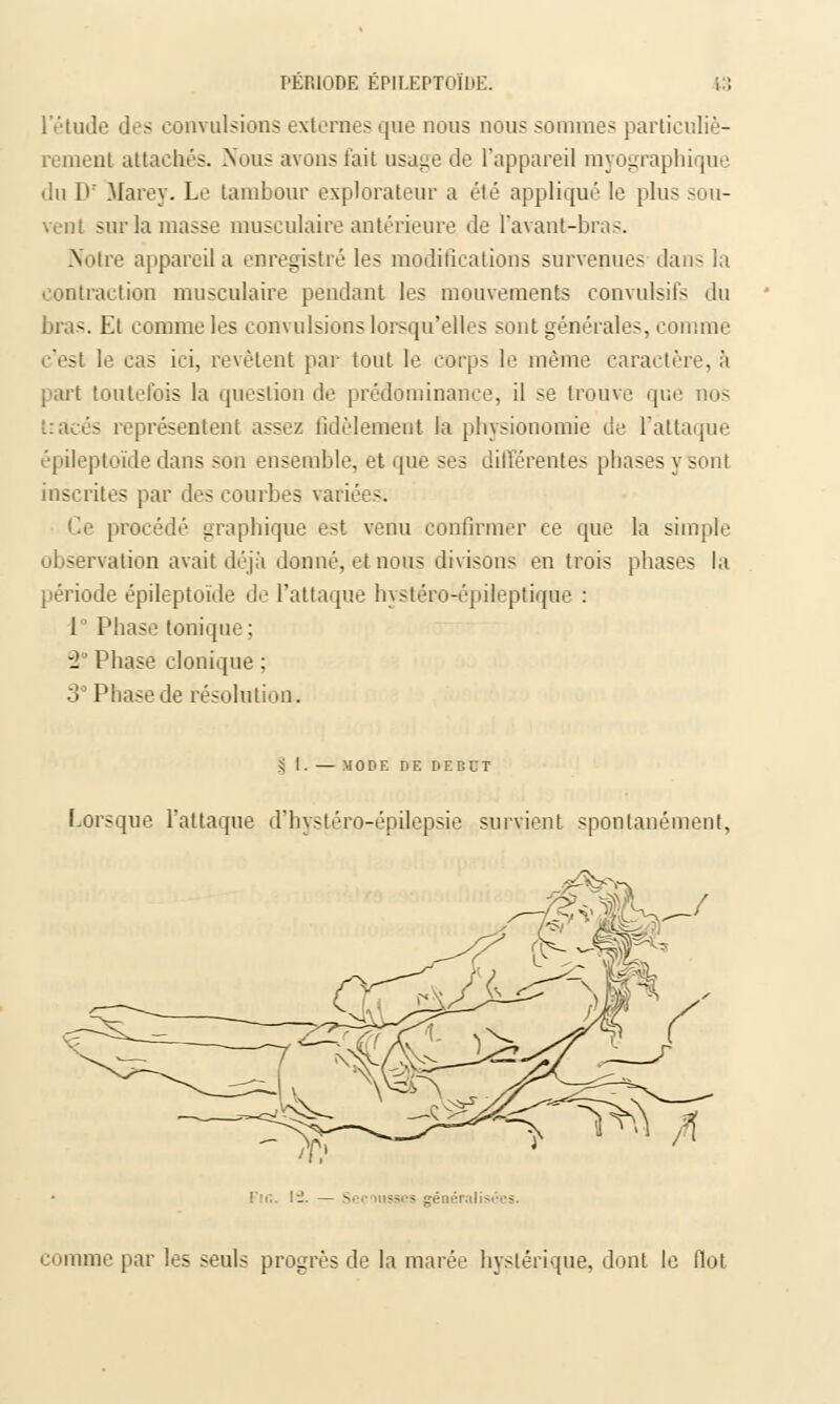PERIODE ÉP1I.F.PTOÏDE. 13 l'étude des convulsions externes que nous nous sommes particuliè- remenl attachés. Nous avons fait usage de l'appareil myographique du Pr Marey. Le tambour explorateur a été appliqué le plus sou- vent sur la masse musculaire antérieure de l'avant-bras. Notre appareil a enregistré les modifications survenues dans la contraction musculaire pendant les mouvements convulsifs du bras. Et comme les convulsions lorsqu'elles sont générales, comme c'est le cas ici, revêtent par tout le corps le même caractère, à part toutefois la question de prédominance, il se trouve que nos tracés représentent assez fidèlement la physionomie de l'attaque épileptoïde dans son ensemble, et que ses différentes phases y sont inscrites par des courbes variées. Ce procédé graphique est venu confirmer ce que la simple observation avait déjà donné, et nous divisons en trois phases la période épileptoïde de l'attaque hystéro-épileptique : 1° Phase tonique; 2 Phase clonique ; 3° Phase de résolution. S I. — MODE DE DÉBUT Lorsque l'attaque d'hystéro-épilepsie survient spontanément, comme par les seuls progrès de la marée hystérique, dont le flot