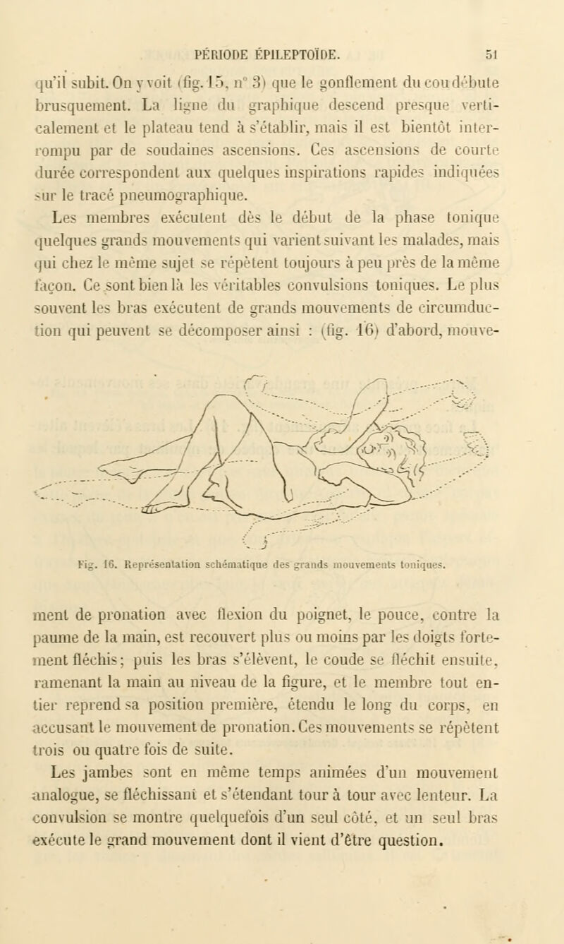 qu'il subit.On yvoit (fig. L5, m 3) que le gonflement ducoudébute brusquement. La ligne du graphique descend presque verti- calement et le plateau tend à s'établir, mais il est bientôt inter- rompu par de soudaines ascensions. Ces ascensions de courte durée correspondent aux quelques inspirations rapides indiquées sur le tracé pneumographique. Les membres exécutent dès le début de la phase tonique quelques grands mouvements qui varient suivant les malades, mais qui cbez le même sujet se répètent toujours à peu près de la même façon. Ce sont bien là les véritables convulsions toniques. Le plus souvent les bras exécutent de grands mouvements de circumduc- tion qui peuvent se décomposer ainsi : (fig. 16) d'abord, mouve- $l'\ Fig. 16. Représentation schématique des grands mouvements toniques. ment de pronation avec flexion du poignet, le pouce, contre la paume de la main, est recouvert plus ou moins par les doigts forte- ment fléchis; puis les bras s'élèvent, le coude se fléchit ensuite, ramenant la main au niveau de la figure, et le membre tout en- tier reprend sa position première, étendu le long du corps, en accusant le mouvement de pronation. Ces mouvements se répètent trois ou quatre fois de suite. Les jambes sont en même temps animées d'un mouvement analogue, se fléchissant et s'étendant tour à tour avec lenteur. La convulsion se montre quelquefois d'un seul côté, et un seul bras exécute le grand mouvement dont il vient d'être question.