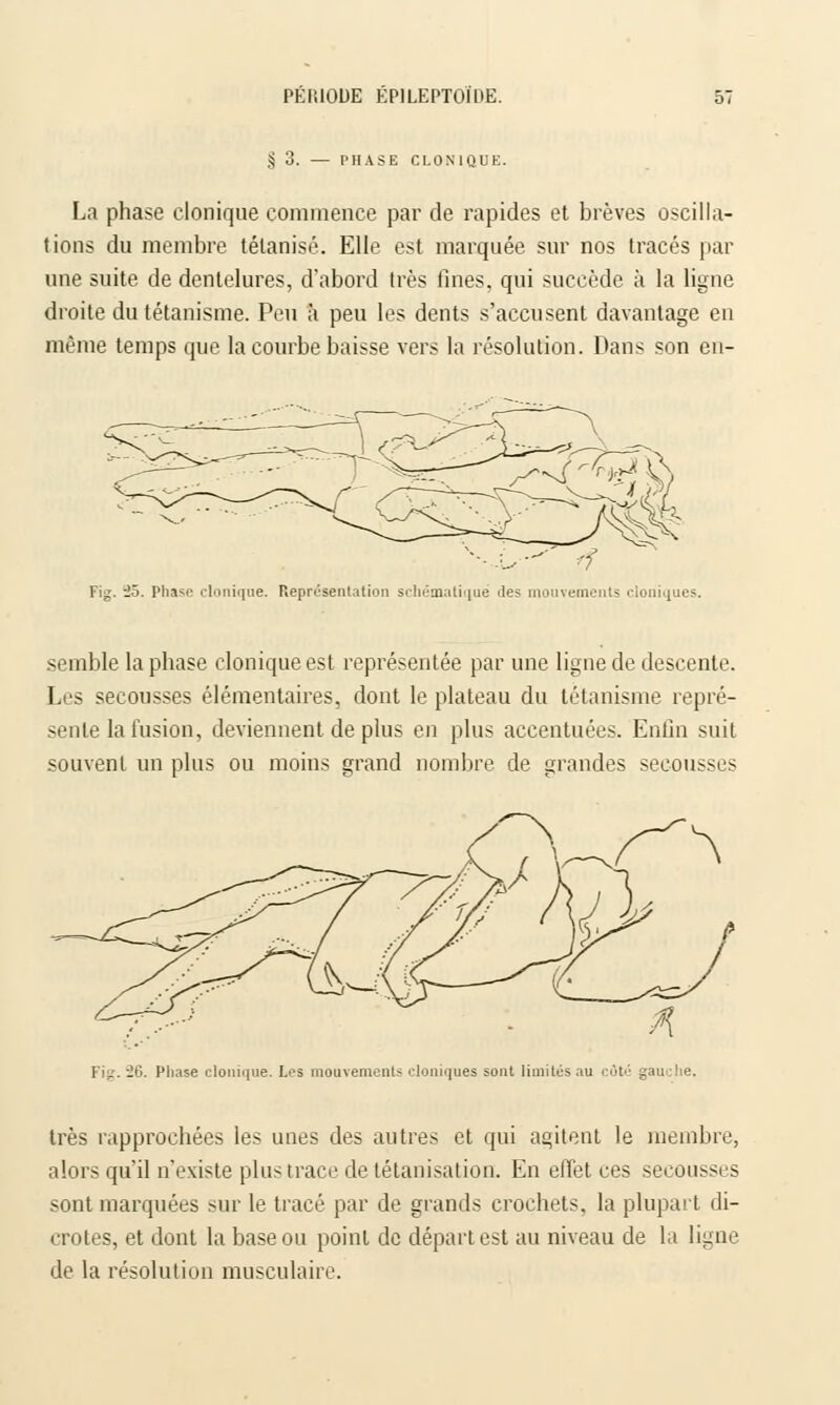 § 3. PHASE CLONIQUE. La phase clonique commence par de rapides et brèves oscilla- tions du membre tétanisé. Elle est marquée sur nos tracés par une suite de dentelures, d'abord très fines, qui succède à la ligne droite du tétanisme. Peu à peu les dents s'accusent davantage en même temps que la courbe baisse vers la résolution. Dans son en- Fig. iô. Phase clonique. Représentation schématique 'les mouvements cloniques. semble la phase clonique est représentée par une ligne de descente. Les secousses élémentaires, dont le plateau du tétanisme repré- sente la fusion, deviennent de plus en plus accentuées. Enfin suit souvent un plus ou moins grand nombre de grandes secousses Fig. 26. Phase clonique. Les mouvements cloniques sont limités au côté gau :he. très rapprochées les unes des autres et qui agitent le membre, alors qu'il n'existe plus trace de tétanisation. En effet ces secousses sont marquées sur le tracé par de grands crochets, la plupart di- crotes, et dont la base ou point de départ est au niveau de la ligne de la résolution musculaire.