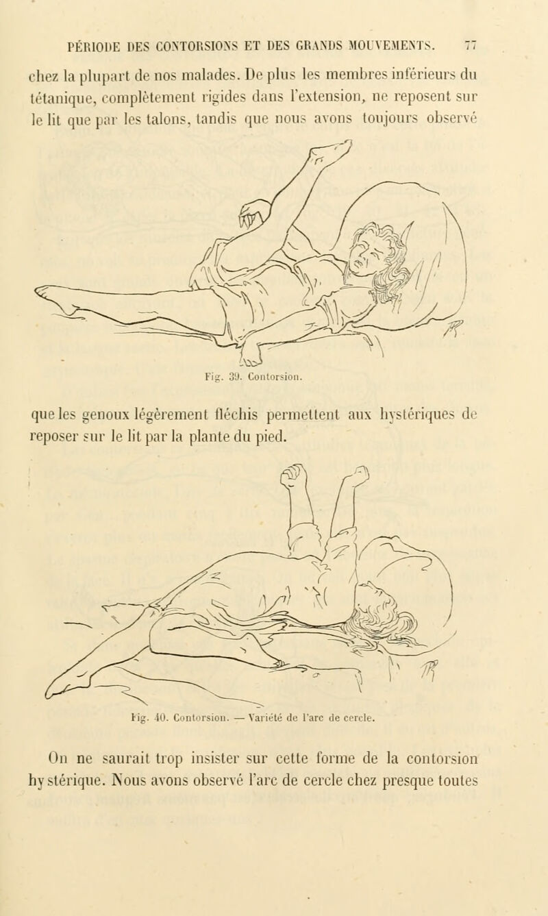 chez la plupart de nos malades. De plus les membres inférieurs du tétanique, complètement rigides dans l'extension, ne reposent sur le lit que par les talons, tandis que nous avons toujours observé Fit;. o'J. Contorsion. que les genoux légèrement fléchis permettent aux hystériques de reposer sur le lit par la plante du pied. Hg. 40. Contorsion. — Variété de l'arc île cercle. On ne saurait trop insister sur cette forme de la contorsion hystérique. Nous avons observé l'arc de cercle chez presque toutes