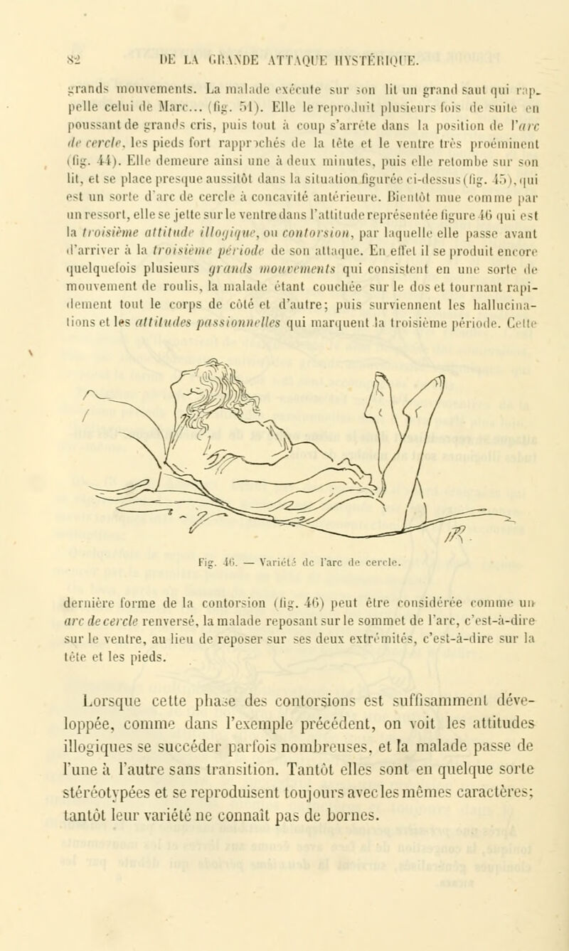 grands mouvements. La malade exécute sur son lit un grand saut qui rap. pelle celui de Marc... 6g. 51). Elle lereproduil plusieurs fois de suite en poussant de grands cris, puis tout à coup s'arrête dans la position de l'arc de cercle, les pieds fort rapprochés de la tête et le ventre lié- proéminent (fig. i i i. Elle demeure ainsi une à deux minutes, puis elle retombe sur son lit, et se place presque aussitôt dans la situation figurée ci-dessusi lîg. 15 i,qui est un sorte d'arc de cercle à concavité antérieure. Bientôt mue comme par h n ressort, elle se jette sur le ventre clans l'attitude représentée ligure 16 qui est la troisième attitude illogique, ou contorsion, par laquelle elle passe avant d'arriver à la troisième péi iode de sou attaque. En effet il se produit encore quelquefois plusieurs grands mouvements qui consistent en une sorte de mouvement de roulis, la malade étant couchée sur le dus et tournant rapi- dement tout le corps de côté et d'autre; puis surviennent les hallucina- tions et les attitudes passionnelles qui marquent la troisième période. Celte Fig. 4(1. — Variété de l'arc de cercle. dernière forme delà contorsion (fig. 46) peut être considérée comme un arc de cercle renversé, la malade reposant sur le sommet de l'arc, c'est-à-dire sur le ventre, au lieu de reposer sur ses deux extrémités, c'est-à-dire sur la tète et les pieds. Lorsque cetle phase des contorsions est suffisamment déve- loppée, comme dans l'exemple précédent, on voit les attitudes illogiques se succéder parfois nombreuses, et la malade passe de l'une à l'autre sans transition. Tantôt elles sont en quelque sorte stéréotypées et se reproduisent toujours avec les mêmes caractères: tantôt leur variété ne connaît pas de bornes.