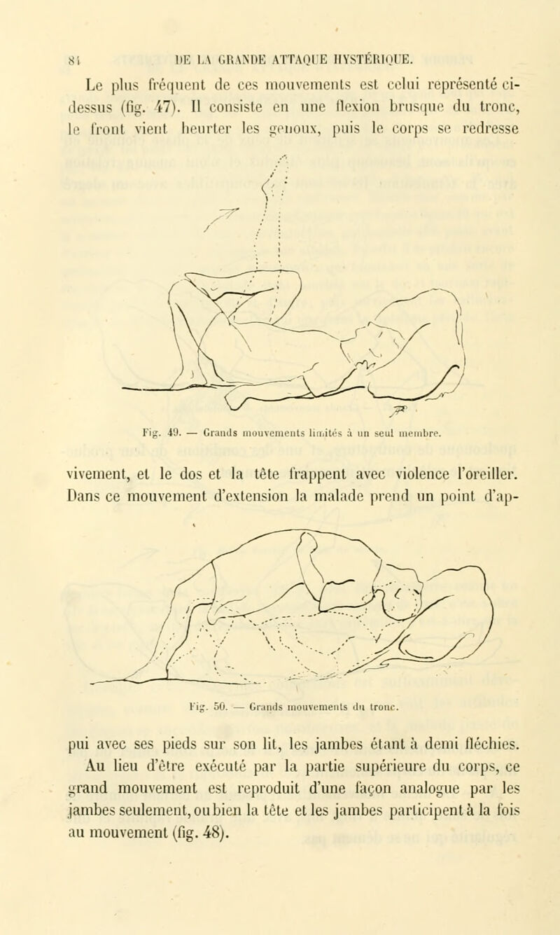 Le plus fréquent de ces mouvements est celui représenté ci- dessus (fig. 47). Il consiste en une flexion brusque du tronc, le front vient heurter les genoux, puis le corps se redresse Fig. 49. — Grands mouvements limités a un seul membre. vivement, et le dos et la tête frappent avec violence l'oreiller. Dans ce mouvement d'extension la malade prend un point d'ap- Fig. 50. — Grands mouvements du tronc. pui avec ses pieds sur son lit, les jambes étant à demi fléchies. Au lieu d'être exécuté par la partie supérieure du corps, ce grand mouvement est reproduit d'une façon analogue par les jambes seulement, ou bien la tête et les jambes participent à la fois au mouvement (fig. 48).