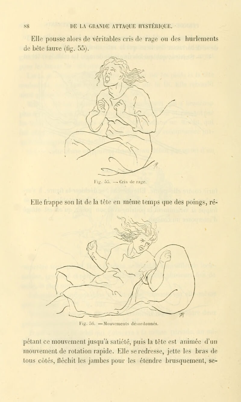 Elle pousse alors de véritables cris de rage ou des hurlements de bête fauve (fig. 55). i _ 55 .Cris de i° Elle frappe son lit de la tête en même temps que des poings, ré- Fig. 56. —Mouvements désordonnés. pétant ce mouvement jusqu'à satiété, puis la tête est animée d'un mouvement de rotation rapide. Elle se redresse, jette les bras de tous cotés, fléchit les jambes pour les étendre brusquement, se-