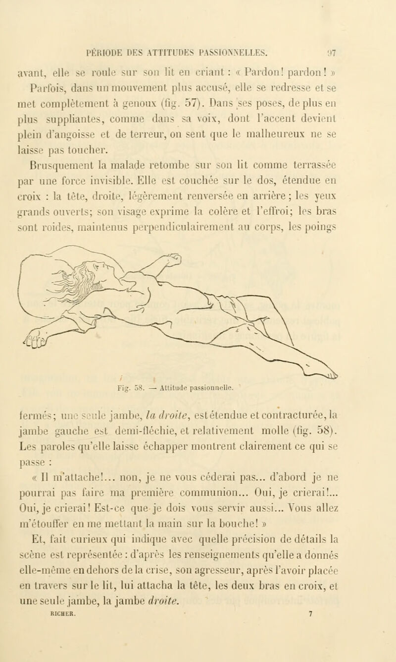 avant, elle se roule sur son lit en criant: «Pardon! pardon! » Parfois, dans unmouvement pins accusé, elle se redresse et se met complètement à genoux (fig. 57). Dans ses poses, de plus en [ilus suppliantes, comme dans sa voix, dont l'accent devienl plein d'angoisse et de terreur, on sent que le malheureux ne se laisse pas toucher. Brusquement la malade retombe sur son lit comme terr par une force invisible. Elle est couchée sur le dos, étendue en croix : la tête, droite, légèrement renversée en arrière ; les yeux grands ouverts; son visage exprime la colère et l'effroi; les bras sont roides, maintenus perpendiculairement au corps, les poings Fig. 53. — Atlitude passionnelle. fermés; un - ule jambe, la droite, estétendueetcontracturée,la jambe gauche est demi-fléchie, et relativement molle (fig. 58). Les paroles qu'elle laisse échapper montrent clairement ce qui se passe : « Il m'attache!... non, je ne vous céderai pas... d'abord je ne pourrai pas faire ma première communion... Oui, je crierai!... Oui, je crierai! Est-ce que je dois vous servir aus>i... Vous allez m'étouffer en me mettant la main sur la bouche! » Et. fait curieux qui indique avec quelle précision de détails la scène est représentée : d'après les renseignements qu'elle a donnés elle-même en dehors delà crise, son agresseur, après l'avoir placée en travers sur le lit, lui attacha la tête, les deux bras en croix, et une seule jambe, la jambe droite