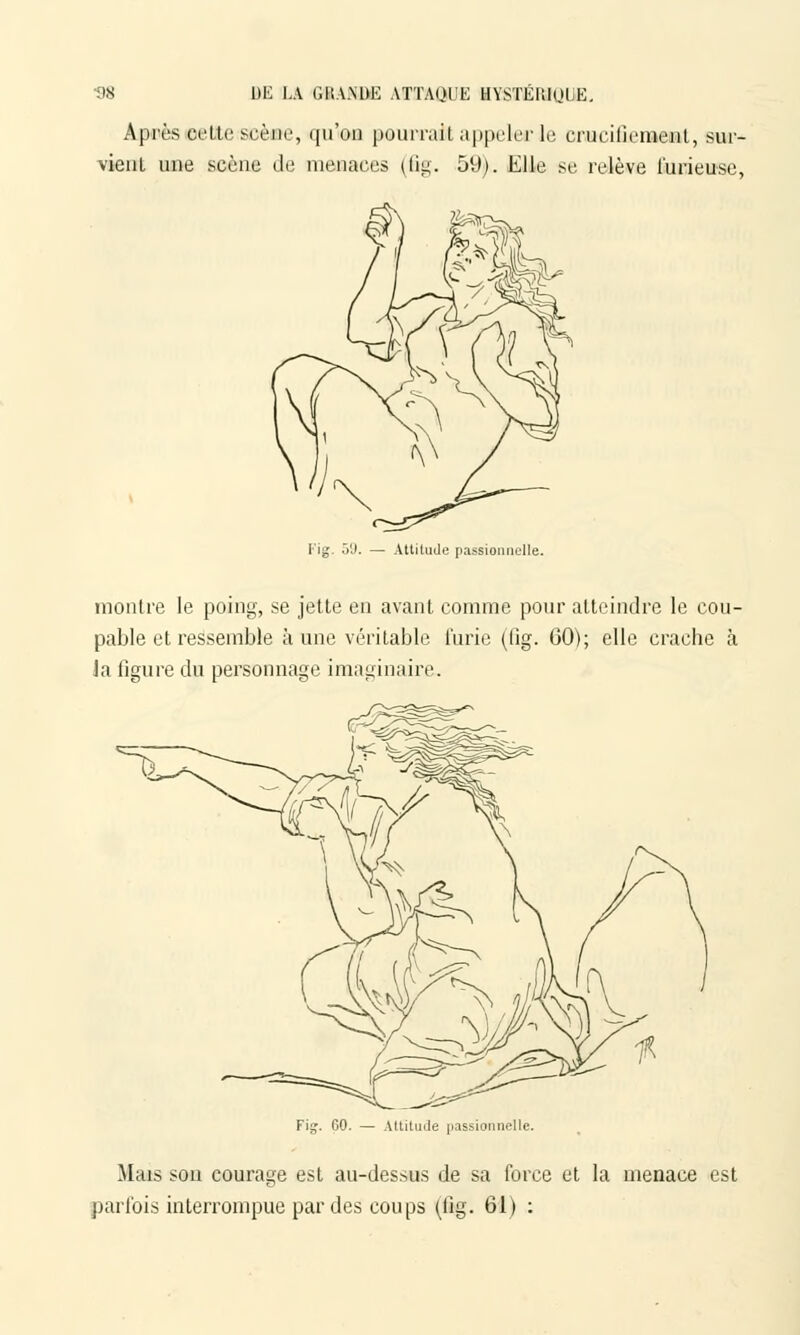 ■98 BE LA r.HA.MU': ATTAQlH HYSTÉliKJUE. Après celte scène, qu'on pourrait appeler le crucifiement, sur- vient une scène de menaces (fig. 51»). Elle se relève furieuse, Fig. 59. — Attitude passionnelle. montre le poing, se jette en avant comme pour atteindre le cou- pable et ressemble aune véritable furie (fig. 60); elle crache à la figure du personnage imaginaire. Fig. 60. — Attitude passionnelle. Mais son courage est au-dessus de sa force et la menace est parfois interrompue par des coups (fig. 61) :