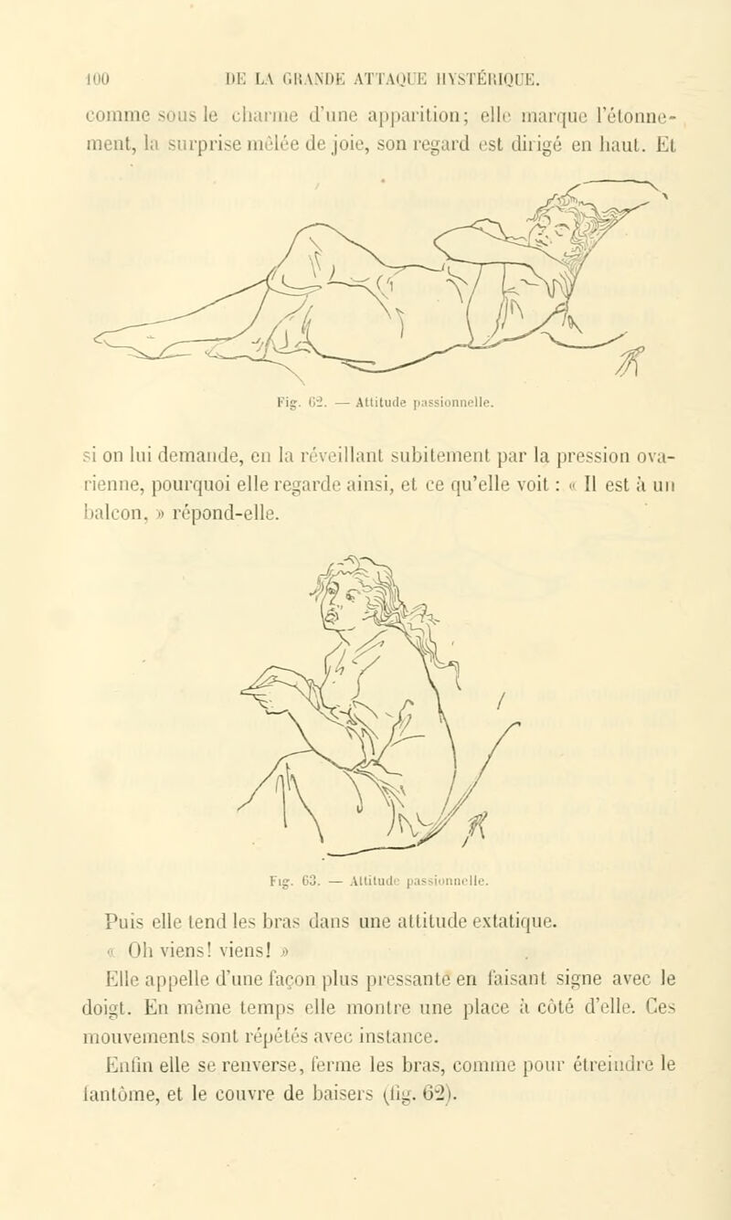 connue sons le charme d'une apparition; elle marque Tâtonne- ment, la surprise mêlée de joie, son regard est dirigé en haut. Et Kig. 62. — Attitude passionnelle. si on lui demande, en la réveillant subitement par la pression ova- rienne, pourquoi elle regarde ainsi, et ce qu'elle voit : « Il est à un balcon, » répond-elle. Fie. 03. Altitude i Puis elle tend les liras dans une attitude extatique. « Oh viens! viens! •> Elle appelle d'une façon plus pressante en taisant signe avec le doigt. En même temps elle montre une place à coté d'elle. Ces mouvements sont répétés avec instance. Enfin elle se renverse, ferme les bras, comme pour étreindre le fantôme, et le couvre de baisers (fig. 62).