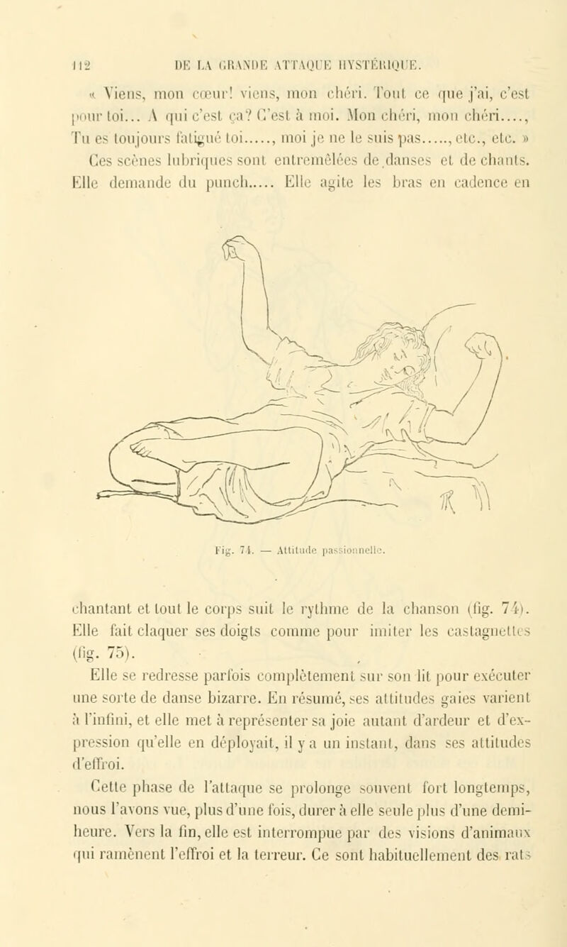 « Viens, mon cœur! viens, mon chéri. Tout ce que j'ai, c'est pour toi... A qui c'esl ça? C'esl à moi. Mon chéri, mon chéri Tu es toujours fatigué toi , moi je ne le suis pas etc., etc. » Ces scènes lubriques sont entremêlées de danses et de chants. Kilo demande du punch Elle agite les liras en cadence i o l ig. i i — Attitude pas ionnell chantant et tout le corps suit le rythme de la chanson (fig. 74). Elle fait claquer ses doigts comme pour imiter les castagnettes (fig. 75). Elle se redresse parfois complètement sur son lit pour exécuter une sorte de danse bizarre. En résumé, ses attitudes gaies varient à l'infini, et elle met à représenter sa joie autant d'ardeur et d'ex- pression qu'elle en déployait, il y a un instant, dans ses attitudes d'effroi. Cette phase de l'attaque se prolonge souvent fort longtemps, nous l'avons vue, plus d'une fois, durer à elle seule plus d'une demi- heure. Vers la fin, elle est interrompue par des visions d'animaux qui ramènent l'effroi et la terreur. Ce sont habituellement des rat i