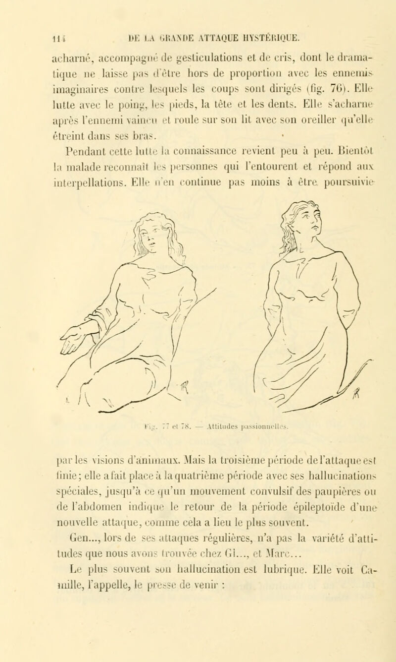 acharné, accompagné de gesticulations et de cris, dont le drama- tique ne laisse pas d être hors de proportion avec les ennemis imaginaires contre lesquels les coups sonl dirigés (fig. 76). Elle lutte avec le poiiiL;. les pieds, la tète cl les dents. Kl le s'acharne après l'ennemi vaincu el roule sur son lit avec son oreiller qu'elle êtreint dans ses bras. Pendant cette lui!>• la connaissance revienl peu à peu. Bientôt la maladereconnaîl 1rs personnes qui l'entourent et répond aux interpellations. Elle n'en continue pas inoins à être poursuivie el T.s. — Attitudes passionnelles. parles visions d'animaux. .Mais la troisième période de l'attaque es I linie; elle a l'ait place à la quatrième période avec ses hallucinations spéciales, jusqu'à ce qu'un mouvement convulsif des paupières ou de l'abdomen indique le retour de la période épileptoïde d'une nouvelle attaque, comme cela a lieu le plus souvent. Gen..., lors de ses attaques régulières, n'a pas la variété d'atti- tudes que nous avons trouvée chez Gl..., el .Mari1... Le plus souvent son hallucination est lubrique. Klle voit Ca- mille, l'appelle, le presse de venir :