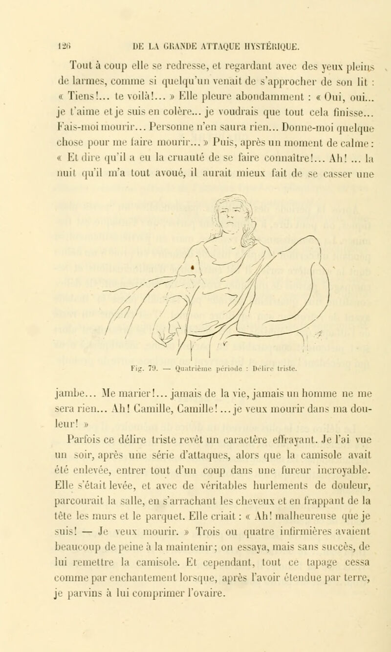 Tout à coup elle se redresse, et regardant avec des yeux pleins de larmes, comme si quelqu'un venait de s'approcher de son lit : « Tiens!... te voilà!... » Elle pleure abondamment : « Oui, oui... je l'aime et je suis en colère... je voudrais que tout cela finisse... Fais-moi mourir... Personne n'en saura rien... Donne-moi quelque chose pour taire mourir...» Puis, après un moment de calme: « Et dire qu'il a eu la cruauté de se faire connaître!... Ah! ... la nuit qu'il m'a tout avoué, il aurait mieux l'ait de se casser une Fig. 79. — Quatrième période : Délire triste. jambe... Me marier!... jamais de la vie, jamais un homme ne me sera rien... Ah! Camille, Camille!... je veux mourir dans ma dou- leur! i Parfois ce délire triste revêt un caractère effrayant. Je l'ai vue un soir, après une série d'attaques, alors que la camisole avait été enlevée, entrer tout d'un coup dans une fureur incroyable. Elle -'était levée, et avec de véritables hurlements de douleur, parcourait la salle, en s'arrachant les cheveux et en frappant de la tête les murs et le parquet. Elle criait : « Ah! malheureuse que je suis! — Je veux mourir. » Trois un quatre infirmières avaient beaucoup de peine à la maintenir; on essaya, mais -ans succès, île lui remettre la camisole. Kl cependant, tout ce lapage cessa comme par enchantement lorsque, après l'avoir étendue par terre, je pai vin- ii lui comprimer l'ovaire.