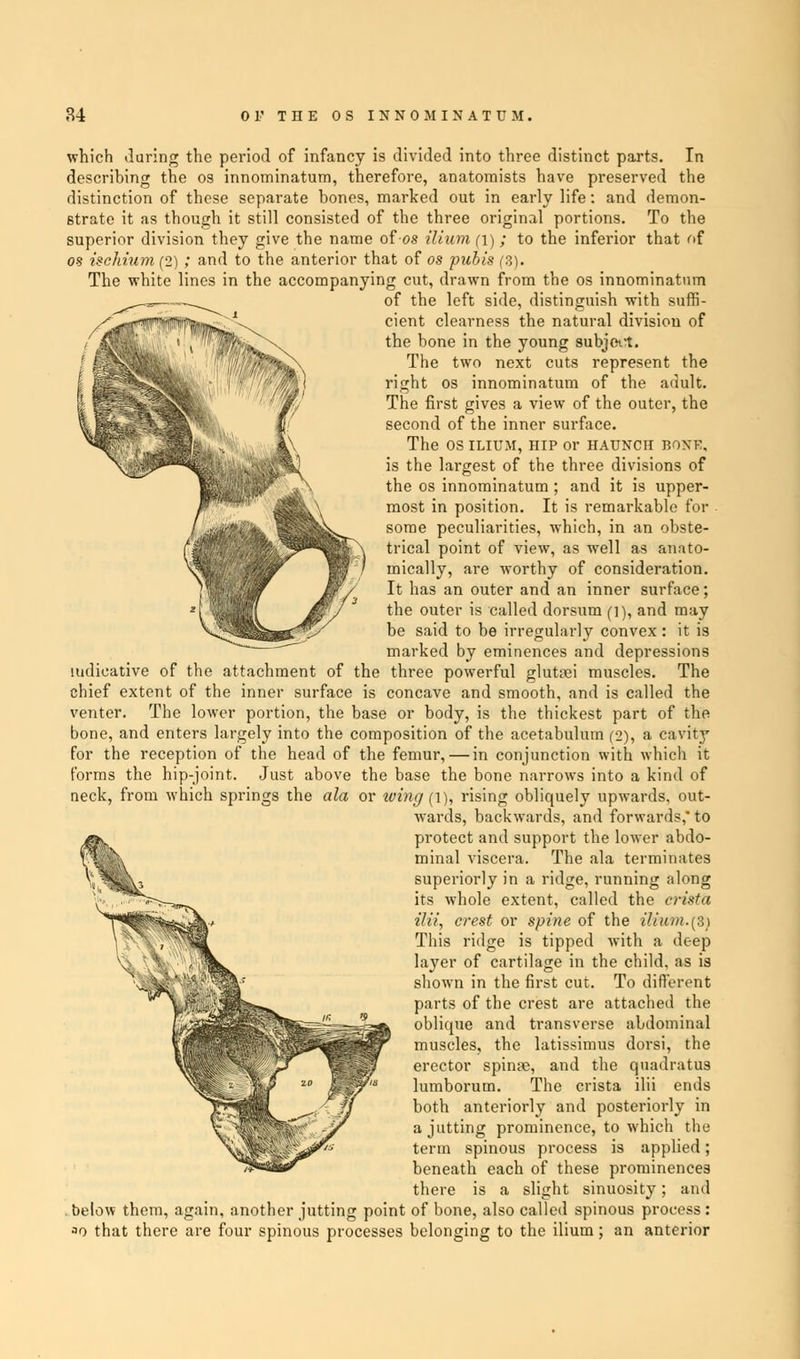 which during the period of infancy is divided into three distinct parts. In describing the os innominatum, therefore, anatomists have preserved the distinction of these separate hones, marked out in early life: and demon- strate it as though it still consisted of the three original portions. To the superior division they give the name of-os ilium (i) ; to the inferior that of os ischium (2) ; and to the anterior that of os pubis (3). The white lines in the accompanying cut, drawn from the os innominatum of the left side, distinguish with suffi- cient clearness the natural division of the bone in the young subjort. The two next cuts represent the right os innominatum of the adult. The first gives a view of the outer, the second of the inner surface. The OS ILIUM, hip or HAUNCH BONE, is the largest of the three divisions of the os innominatum ; and it is upper- most in position. It is remarkable for some peculiarities, which, in an obste- trical point of view, as well as anato- mically, are worthy of consideration. It has an outer and an inner surface; the outer is called dorsum (i), and may be said to be irregularly convex : it is marked by eminences and depressions indicative of the attachment of the three powerful glutsei muscles. The chief extent of the inner surface is concave and smooth, and is called the venter. The lower portion, the base or body, is the thickest part of the bone, and enters largely into the composition of the acetabulum (2), a cavity for the reception of the head of the femur, — in conjunction with which it forms the hip-joint. Just above the base the bone narrows into a kind of neck, from which springs the ala or wing (i), rising obliquely upwards, out- wards, backwards, and forwards, to protect and support the lower abdo- minal viscera. The ala terminates superiorly in a ridge, running along its whole extent, called the crista ilii, crest or spine of the ilium.(3) This ridge is tipped with a deep layer of cartilage in the child, as is shown in the first cut. To different parts of the crest are attached the oblique and transverse abdominal muscles, the latissimus dorsi, the erector spinne, and the quadratus lumborum. The crista ilii ends both anteriorly and posteriorly in a jutting prominence, to which the term spinous process is applied; beneath each of these prominences there is a slight sinuosity ; and below them, again, another jutting point of bone, also called spinous process : ao that there are four spinous processes belonging to the ilium; an anterior