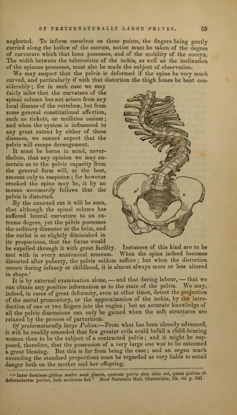 OF PRETERNATURALLY LARGE PELVES 59 neglected. To inform ourselves on these points, the fingers being gently carried along the hollow of the sacrum, notice must be taken of the degree of curvature which that bone possesses, and of the mobility of the coccyx. The width between the tuberosities of the ischia, as well as the inclination of the spinous processes, must also be made the subject of observation. We may suspect that the pelvis is deformed if the spine be very much curved, and particularly if with that distortion the thigh bones be bent con- siderably ; for in such case we may faiily infer that the curvature of the epinal column has not arisen from any local disease of the vertebrae, but from some general constitutional affection, such as rickets, or mollities ossium ; and when the system is influenced to any great extent by either of these diseases, we cannot expect that the pelvis will escape derangement. It must be borne in mind, never- theless, that any opinion we may en- tertain as to the pelvic capacity from the general form will, at the best, amount only to suspicion ; for however crooked the spine may be, it by no means necessarily follows that the pelvis is distorted. By the annexed cut it will be seen, that although the spinal column has suffered lateral curvature to an ex- treme degree, yet the pelvis possesses the ordinary diameter at the brim, and the outlet is so slightly diminished in its proportions, that the foetus would be expelled through it with great facility. Instances of this kind are to be met with in every anatomical museum. When the spine indeed becomes distorted after puberty, the pelvis seldom suffers ; but when the distortion occurs during infancy or childhood, it is almost always more or less altered in shape.1 It is by external examination alone, — and that during labour, — that we can obtain any positive information as to the state of the pelvis. AVe may, indeed, in cases of great deformity, even at other times, detect the projection of the sacral promontory, or the approximation of the ischia, by the intro- duction of one or two fingers into the vagina; but an accurate knowledge of all the pelvic dimensions can only be gained when the soft structures are relaxed by the process of parturition. Of preternaturally large Pelves.—From what has been already advanced, it will be readily conceded that few greater evils could befall a child-bearing woman than to be the subject of a contracted pelvis; and it might be sup- posed, therefore, that the possession of a very large one was to be esteemed a great blessing. But this is far from being the case; and an organ much exceeding the standard proportions must be regarded as very liable to entail danger both on the mother and her offspring. ^ > Inter fceminas gibbas multo sunt plures, quarurn pelvis sine vitio est, quam.quibiis ob deform i tat em partus, inde molestus fiat. Boer Naturalis Med. Obstetrician, lib. vn. p. vil