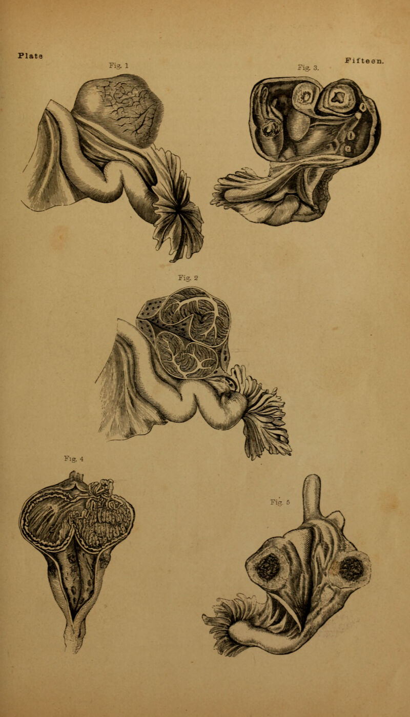 Fig. 1 .Fiftee: Fig, 3. Fig. 2