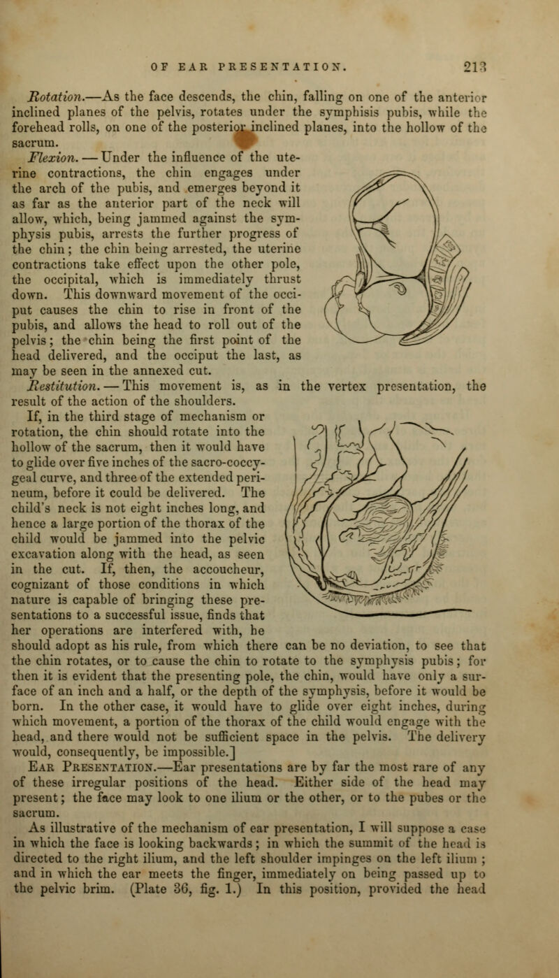 in the vertex presentation, the Rotation.—As the face descends, the chin, falling on one of the anterior inclined planes of the pelvis, rotates under the symphisis pubis, while the forehead rolls, on one of the posterior inclined planes, into the hollow of the sacrum. Flexion. — Under the influence of the ute- rine contractions, the chin engages under the arch of the pubis, and emerges beyond it as far as the anterior part of the neck will allow, which, being jammed against the sym- physis pubis, arrests the further progress of the chin; the chin being arrested, the uterine contractions take effect upon the other pole, the occipital, which is immediately thrust down. This downward movement of the occi- put causes the chin to rise in front of the pubis, and allows the head to roll out of the pelvis; the chin being the first point of the head delivered, and the occiput the last, as may be seen in the annexed cut. Restitution. — This movement is, as result of the action of the shoulders. If, in the third stage of mechanism or rotation, the chin should rotate into the hollow of the sacrum, then it would have to glide over five inches of the sacro-coccy- geal curve, and three of the extended peri- neum, before it could be delivered. The child's neck is not eight inches long, and hence a large portion of the thorax of the child would be jammed into the pelvic excavation along with the head, as seen in the cut. If, then, the accoucheur, cognizant of those conditions in which nature is capable of bringing these pre- sentations to a successful issue, finds that her operations are interfered with, he should adopt as his rule, from which there can be no deviation, to see that the chin rotates, or to cause the chin to rotate to the symphysis pubis; for then it is evident that the presenting pole, the chin, would have only a sur- face of an inch and a half, or the depth of the symphysis, before it would be born. In the other case, it would have to glide over eight inches, during which movement, a portion of the thorax of the child would engage with the head, and there would not be sufficient space in the pelvis. The delivery would, consequently, be impossible.] Ear Presentation.—Ear presentations are by far the most rare of any of these irregular positions of the head. Either side of the head may present; the face may look to one ilium or the other, or to the pubes or the sacrum. As illustrative of the mechanism of ear presentation, I will suppose a ease in which the face is looking backwards; in which the summit of the head is directed to the right ilium, and the left shoulder impinges on the left ilium ; and in which the ear meets the finger, immediately on being passed up to the pelvic brim. (Plate 36, fig. 1.) In this position, provided the head