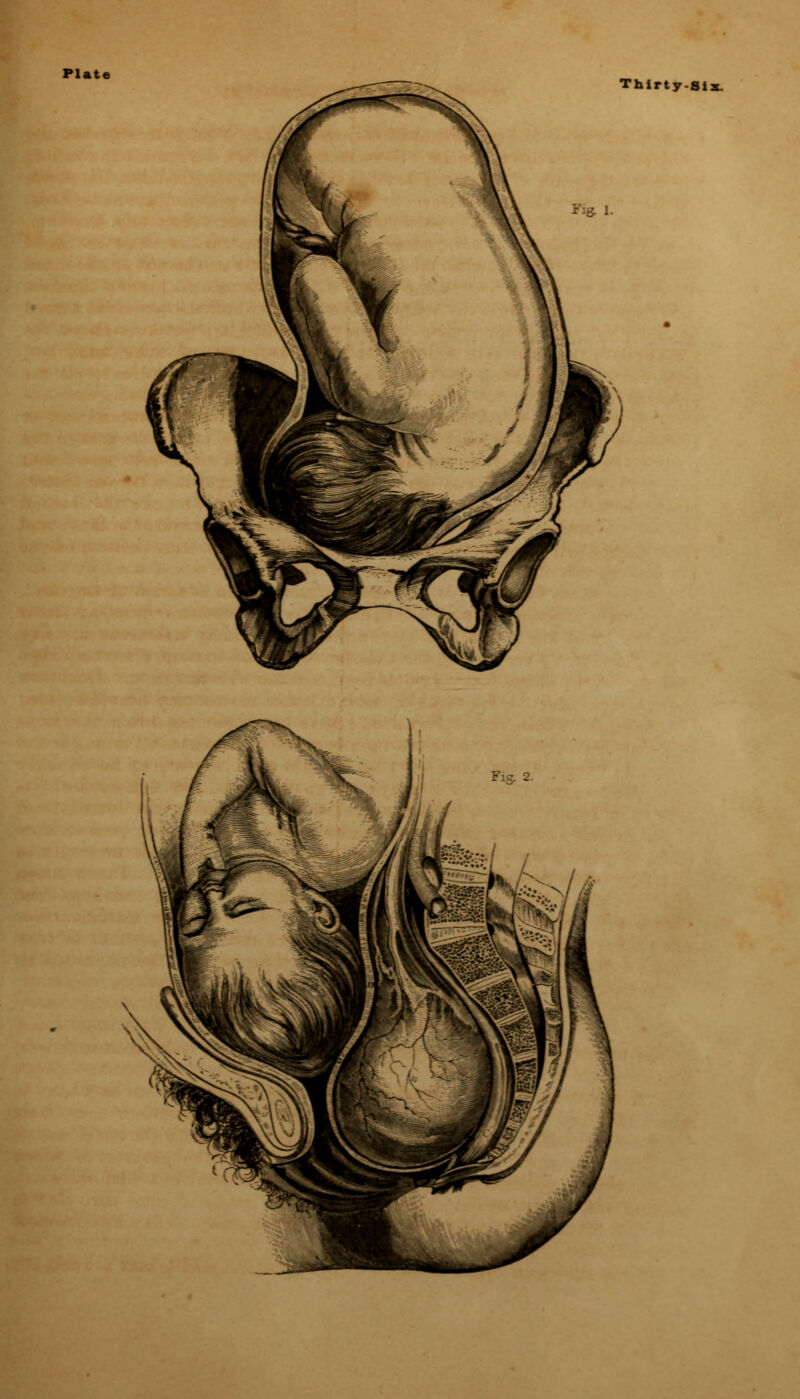 Plate Thirty-Six.
