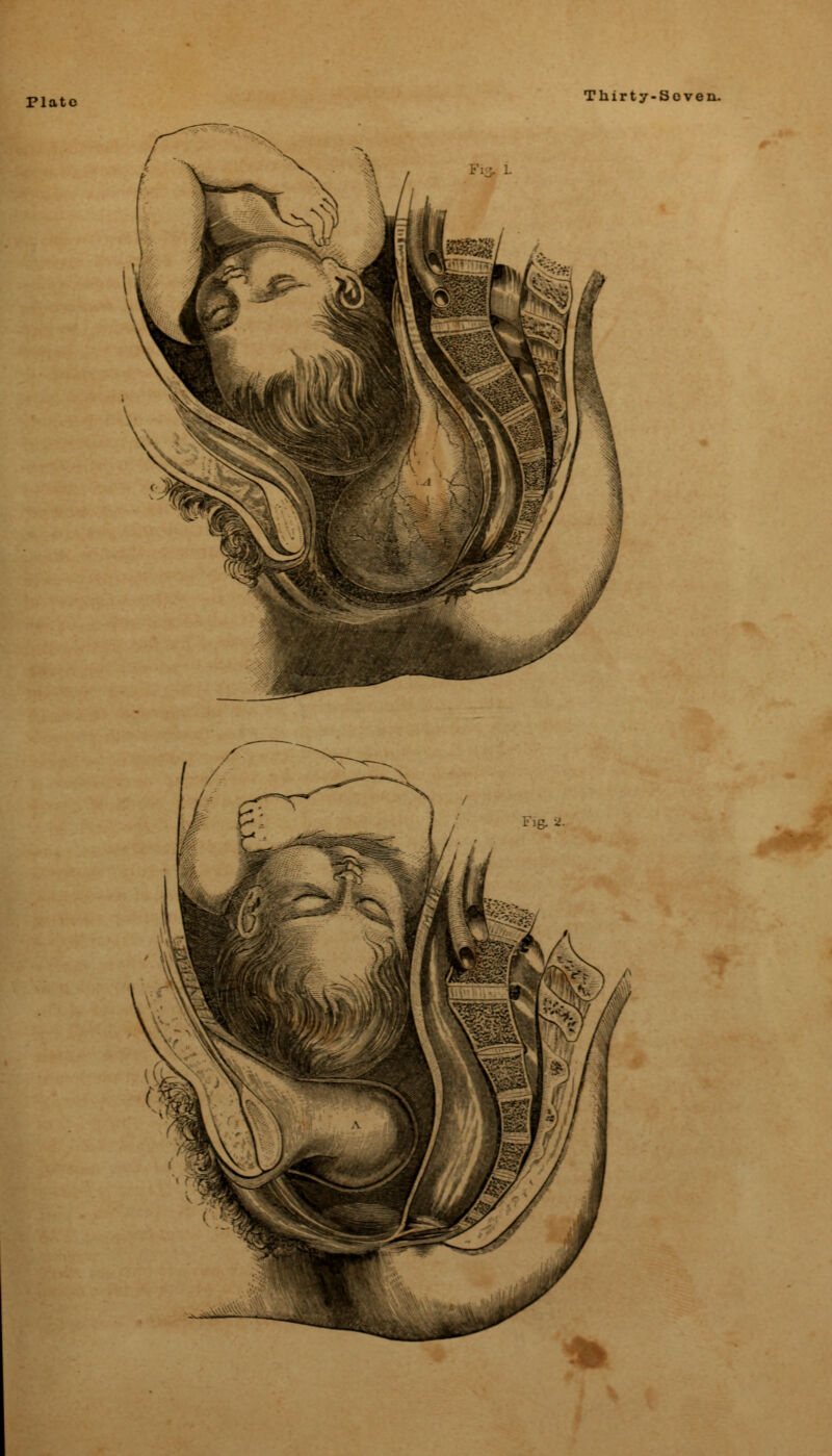 Plate Thirty-Soven.