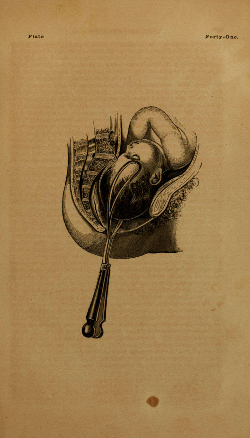 Plate Forty-One.