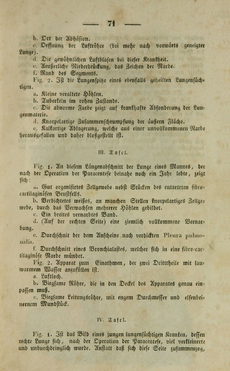 b. Srt ber 3ib^nfton. c Seffnung ber 2uftröf)ce (bei me!)c nad) »orroäctS geneigter Junge). d. Sie geroöfmlichcn Suftblafen bei biefet Äronfr>eit. e. 2feujjer[id)e Ociebcrbrücrung, baS jäeidjen ber 9?arbe. f. 9?anb beS «Segment«. Fig. 2. 3ft bie gungenfpi|e eineS ebenfalls geseilten £ungenfüd)= tigen. a. Äleine veraltete .ipöbjen. b. ^überfein im roijen ßuftanbe. c. Bie abnorme garbe jeigt auf franfljafte Abfonberung bei- ?un= genmatecie. ti. Änotpelartige Sufammenfdjrumpfung bec äufern glacfye. e. Äalfartige Ablagerung, tueldje aus einer unüollfommenen 9carbe IjerauSgefaUen unb bafjer blojigeftellt ift. Hl. Safer. Fig. i. 2fn biefem SMngenabfdjnitt ber Sunge eines Cannes, bec nad) ber Operation ber ^aracentefe beinafje nod) ein 3af)r lebte, jeigt m- ;.. ©ut organift'rteS Sellgeroebe nebft Stücfen beS entarteten ft'&ro« cartilaginöfen Q3rufifeir$. b. 33erbid)teteS loeifjeS, an manchen ©teilen fnorpelartigeS Selige; roebe, buref) baS Sßerroadjfen mehrerer .üpofjlen gebilbet. c. (Sin breites vernarbtes Sanb. d. (Auf ber redjten Seite) eine äiemlid) vollkommene S}ernar= 6ung. e. 25urd)fd)nit bec bem 2Cnfd)eine nad) verbieten Pleura pulmo- nalis. i'. 2)utcrjfd)nitt eines S3rond)ialaffeS, t»eld)er fiel; in eine fit>ro-car= tilaginofe Ocarbe münbet. Fig. 2. Apparat jum Grinatljmen, bec jroei £>rittt!)ei(e mit lau= »armem Süßaffer anjufüllen ift. a. Suftlod). b. SSiegfame Dvofjre, bie in ben jDecfel beS Apparates genau ein= paffen mujj. c. SSiegfame feitungSröfyre, mit engem £ucd;meffer unb elfenbeU uecnem SWunbftücf. IV. Safer. Fig. l. 3ft baS SSilb eines jungen lungenfüd)tigen iteanfen, beffen rechte Cunge fid;, nad) bec Operation bec »Paracentefe, viel verfeinerte unb imburd;biing(id) rourbe. Anfiatt bajj ftcb biefe Seite jufammenäog,