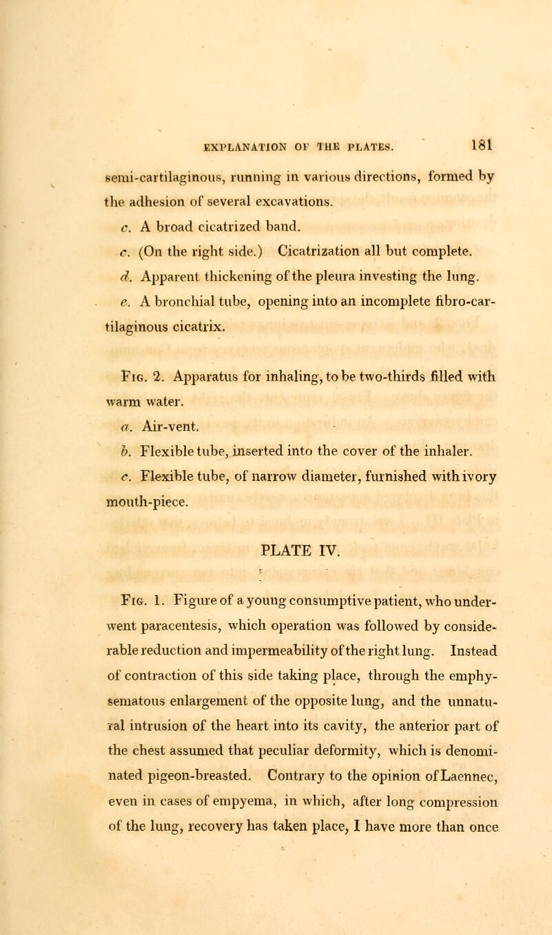 EXPLANATION OF THE PLATES. 181 semi-cartilaginous, running in various directions, formed by the adhesion of several excavations. c. A broad cicatrized band. c. (On the right side.) Cicatrization all but complete. d. Apparent thickening of the pleura investing the lung. e. A bronchial tube, opening into an incomplete fibro-car- tilaginous cicatrix. Pig. 2. Apparatus for inhaling, to be two-thirds filled with warm water. a. Air-vent. b. Flexible tube, inserted into the cover of the inhaler. c. Flexible tube, of narrow diameter, furnished with ivory mouth-piece. PLATE IV. Fig. 1. Figure of a young consumptive patient, who under- went paracentesis, which operation was followed by conside- rable reduction and impermeability of the right lung. Instead of contraction of this side taking place, through the emphy- sematous enlargement of the opposite lung, and the unnatu- ral intrusion of the heart into its cavity, the anterior part of the chest assumed that peculiar deformity, which is denomi- nated pigeon-breasted. Contrary to the opinion of Laennec, even in cases of empyema, in which, after long compression