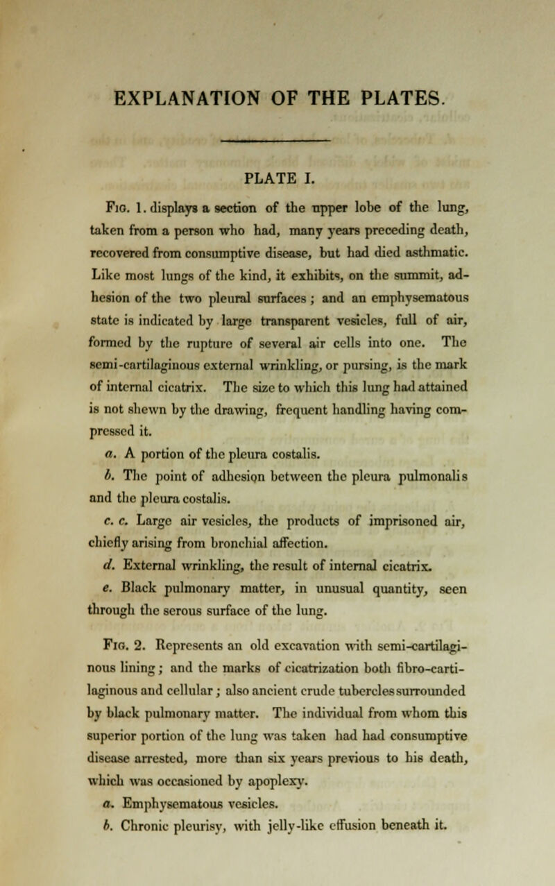 EXPLANATION OF THE PLATES. PLATE I. Fig. 1. displays a section of the upper lobe of the lung, taken from a person who had, many years preceding death, recovered from consumptive disease, but had died asthmatic. Like most lungs of the kind, it exhibits, on the summit, ad- hesion of the two pleural surfaces ; and an emphysematous state is indicated by large transparent vesicles, full of air, formed by the rupture of several air cells into one. The semi-cartilaginous external wrinkling, or pursing, is the mark of internal cicatrix. The size to which this lung had attained is not shewn by the drawing, frequent handling having com- pressed it. a. A portion of the pleura costalis. b. The point of adhesion between the pleura pulmonalis and the pleura costalis. c. c. Large air vesicles, the products of imprisoned air, chiefly arising from bronchial aflfection. d. External wrinkling, the result of internal cicatrix. e. Black pulmonary matter, in unusual quantity, seen through tbe serous surface of the lung. Fig. 2. Represents an old excavation with semi-cartilagi- nous lining; and the marks of cicatrization both fibro-carti- laginous and cellular; also ancient crude tubercles surrounded by black pulmonary matter. The individual from whom this superior portion of the lung was taken had had consumptive disease arrested, more than six years previous to his death, which was occasioned by apoplexy. &. Emphysematous vesicles. b. Chronic pleurisy, with jelly-like effusion beneath it.