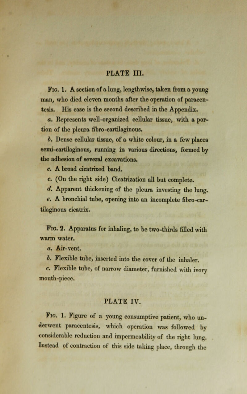 PLATE III. Fig. 1. A section of a lung, lengthwise, taken from a young man, who died eleven months after the operation of paracen- tesis. His case is the second described in the Appendix. a. Represents well-organized cellular tissue, with a por- tion of the pleura fibro-cartilaginous. b. Dense cellular tissue, of a white colour, in a few places semi-cartilaginous, running in various directions, formed by the adhesion of several excavations. c. A broad cicatrized band. c. (On the right side) Cicatrization all but complete, d. Apparent thickening of the pleura investing the lung. e. A bronchial tube, opening into an incomplete fibro -car- tilaginous cicatrix. Fig. 2. Apparatus for inhaling, to be two-thirds filled with warm water. a. Air-vent. b. Flexible tube, inserted into the cover of the inhaler. c. Flexible tube, of narrow diameter, furnished with ivory mouth-piece. PLATE IV. Fig. 1. Figure of a young consumptive patient, who un- derwent paracentesis, which operation was followed by considerable reduction and impermeability of the right lung. Instead of contraction of this side taking place, through the