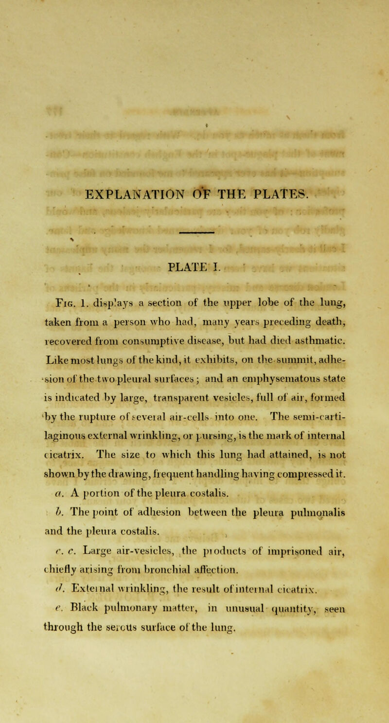 EXPLANATION OF THE PLATES. PLATE I. Fig. 1. displays a section of the upper lobe of the lung, taken from a person who had, many years preceding death, recovered from consumptive disease, but had died asthmatic. Likemost lungs of the kind,it exhibits, on the summit, adhe- sion of the two pleural surfaces; and an emphysematous state is indicated by large, transparent vesicles, full of air, formed by the rupture of several air-cells into one. The semi-carti- laginous external wrinkling, or pursing, is the mark of internal cicatrix. The size to which this lung had attained, is not shown by the drawing, frequent handling having compressed it. a. A portion of the pleura costalis. b. The point of adhesion between the pleura pulmonalis and the pleura costalis. e. c. Large air-vesicles, the pioducts of imprisoned air, chiefly arising from bronchial affection. cf. External wrinkling, the result of internal cicatrix. e. Black pulmonary matter, in unusual quantity, seen through the seioUs surface of the lung.