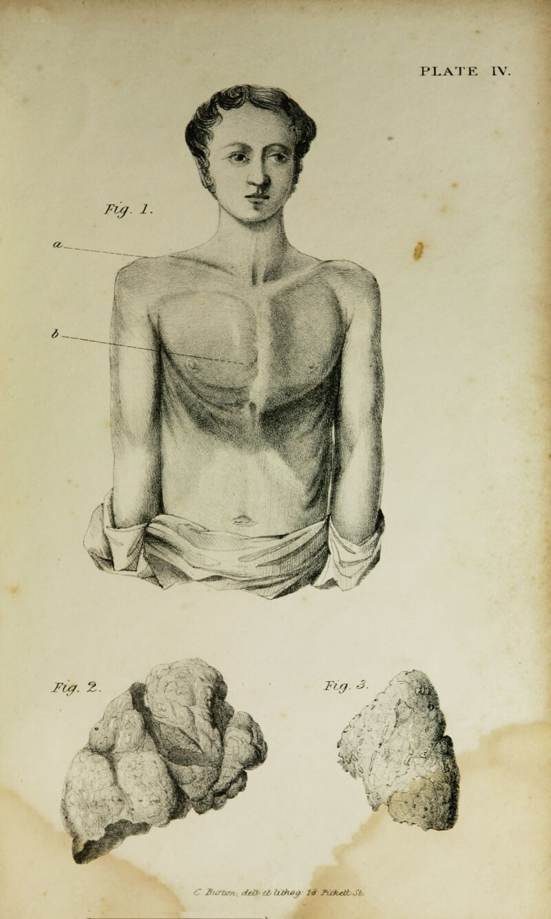 2—. Fig. 2 Fig. 3. J'' , * i •*'' i ■-. 1 i b : i ■ i ' Burton deiMcl Uihog la KdctttSl