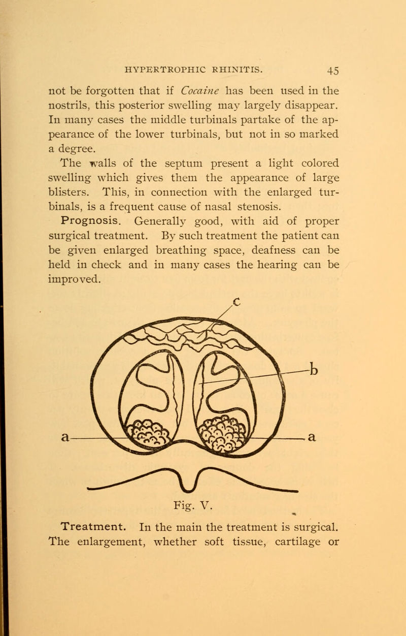 not be forgotten that if Cocaine has been used in the nostrils, this posterior swelling may largely disappear. In man}- cases the middle turbinals partake of the ap- pearance of the lower turbinals, but not in so marked a degree. The walls of the septum present a light colored swelling which gives them the appearance of large blisters. This, in connection with the enlarged tur- binals, is a frequent cause of nasal stenosis. Prognosis. Generally good, with aid of proper surgical treatment. By such treatment the patient can be given enlarged breathing space, deafness can be held in check and in many cases the hearing can be improved. Fig. V. Treatment. In the main the treatment is surgical. The enlargement, whether soft tissue, cartilage or